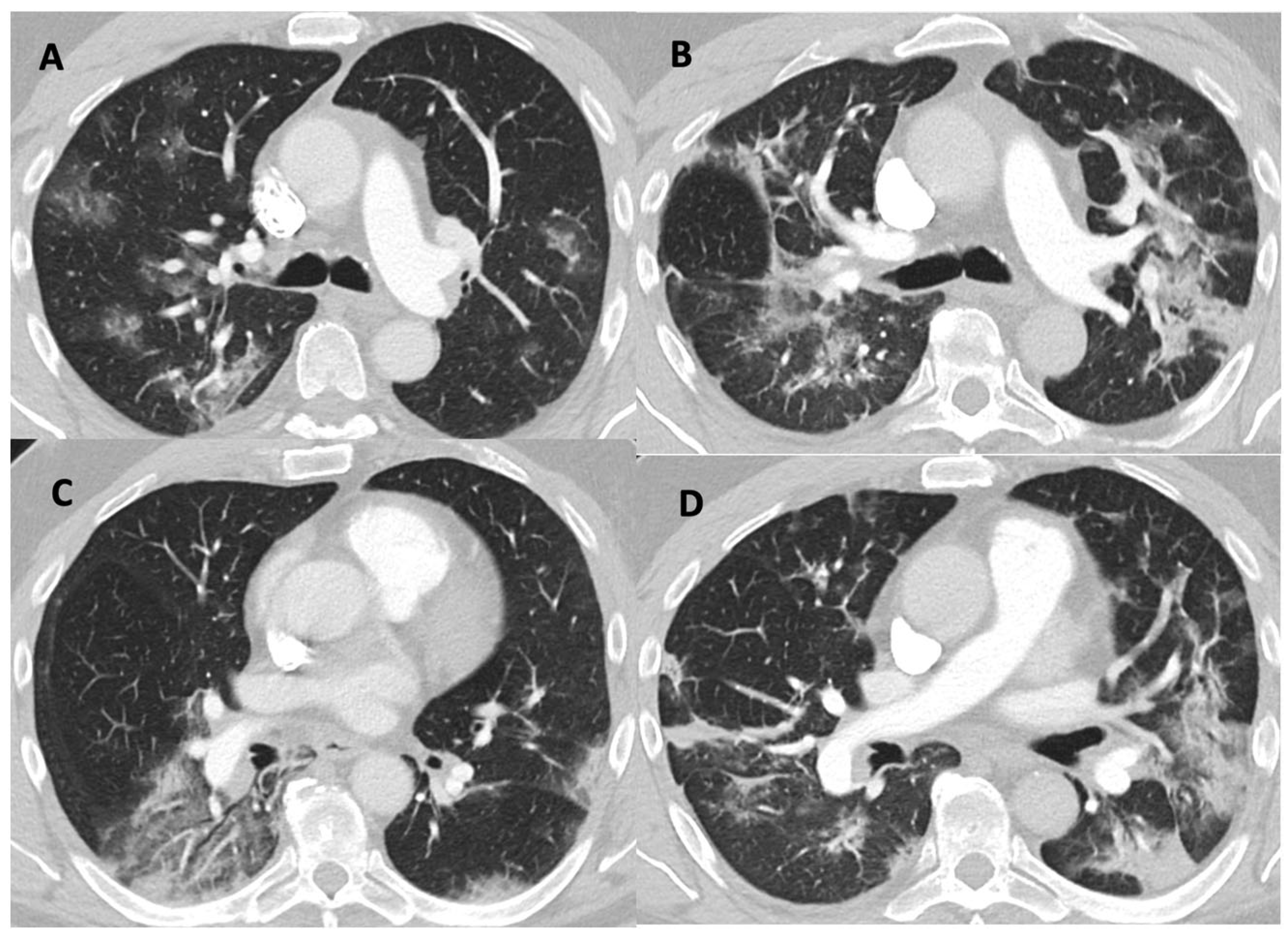 Jcm 12 04850 g004 Jcm 12 04850 g004
