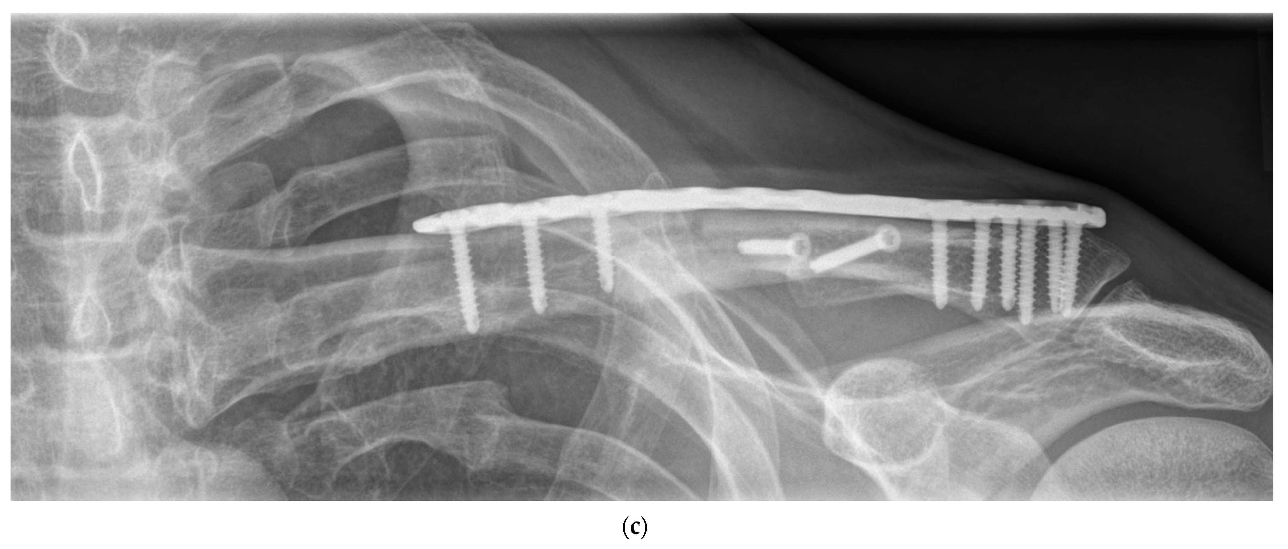 Jcm 12 04878 g001b Jcm 12 04878 g001b