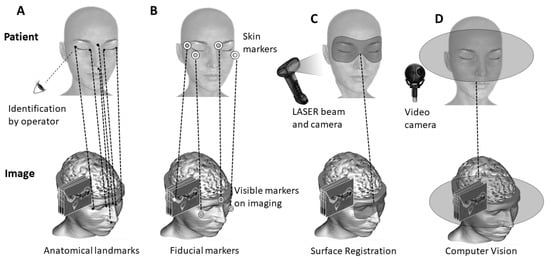 Why Are Appearance-Conscious Patients Preferring Surgical Glue?