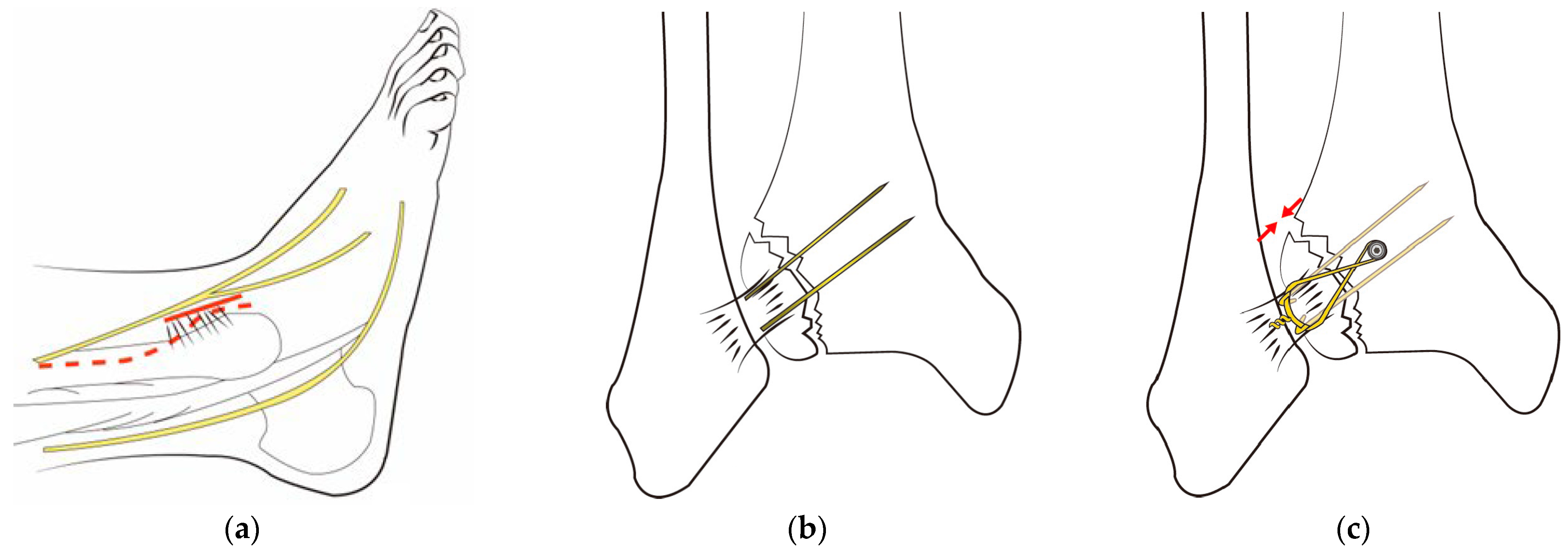 Jcm 12 05490 g002 Jcm 12 05490 g002