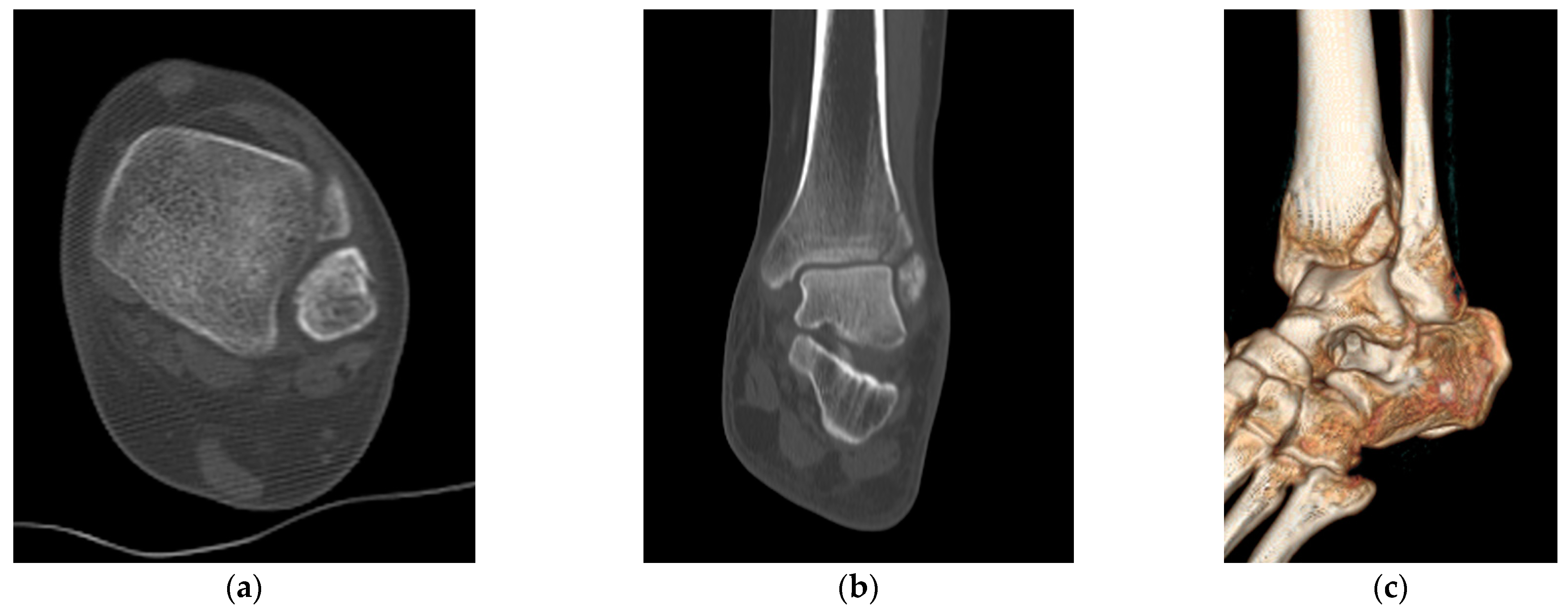 Jcm 12 05490 g004 Jcm 12 05490 g004