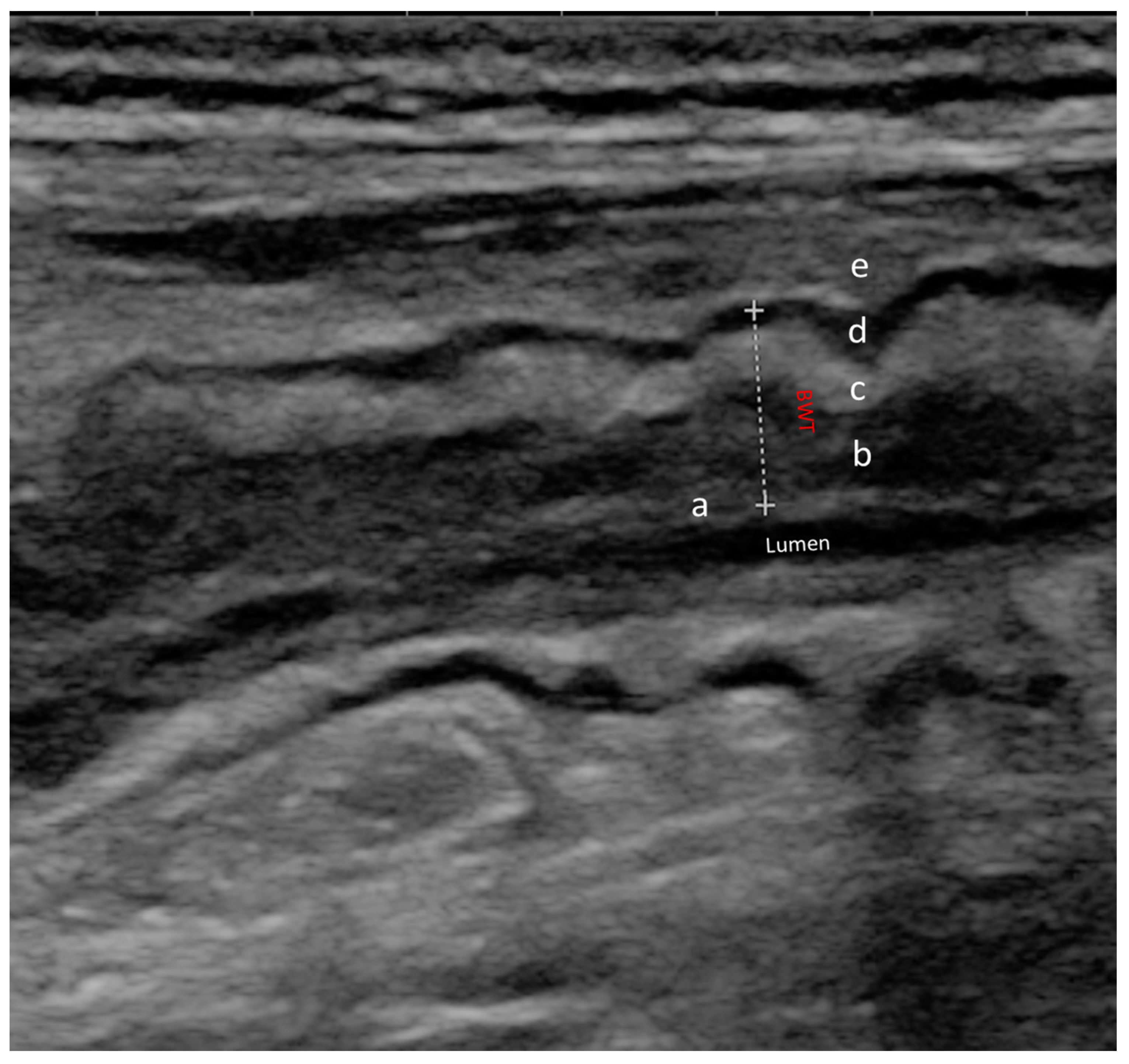 Jcm 12 05933 g002 Jcm 12 05933 g002