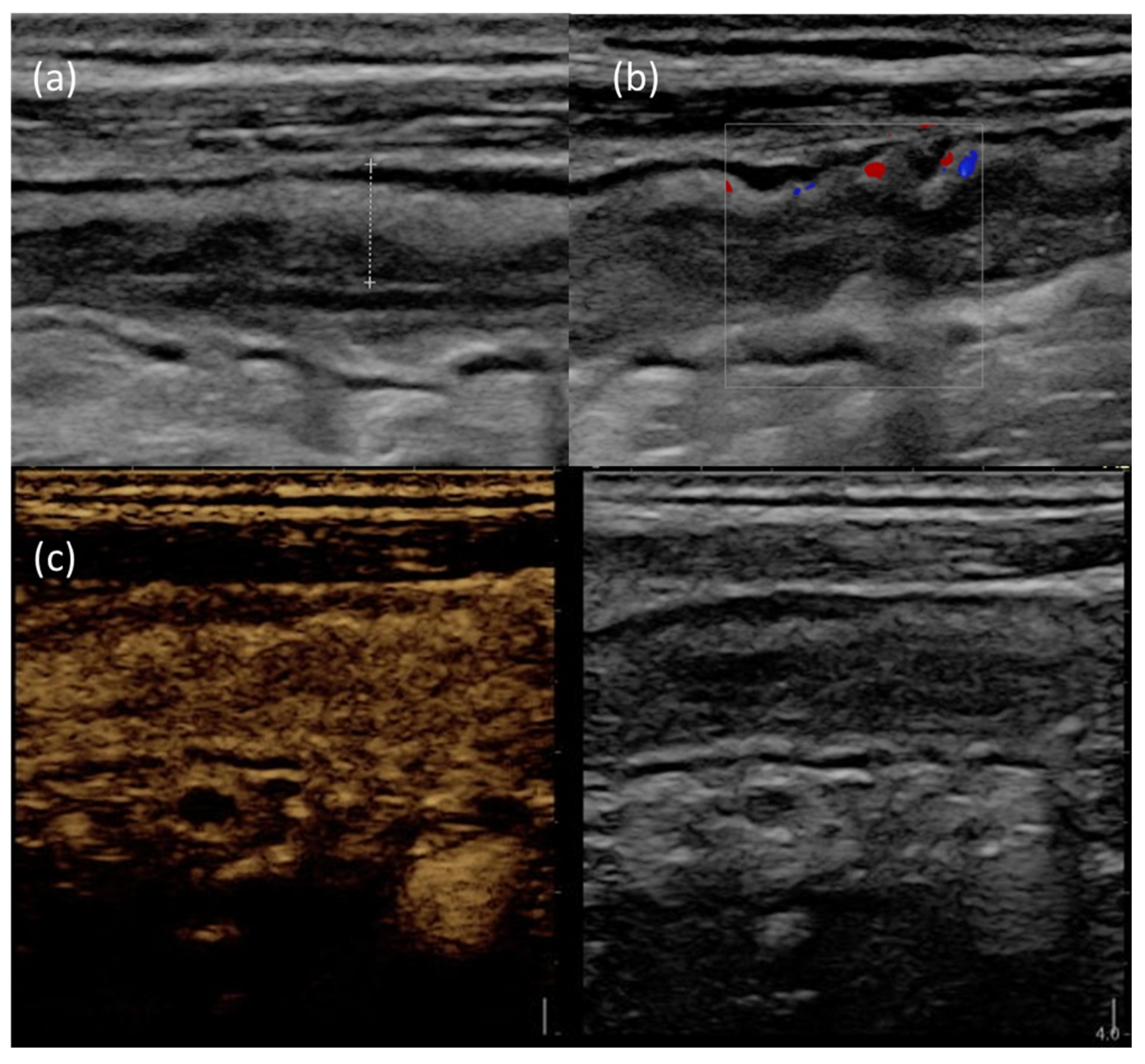 Jcm 12 05933 g003 Jcm 12 05933 g003