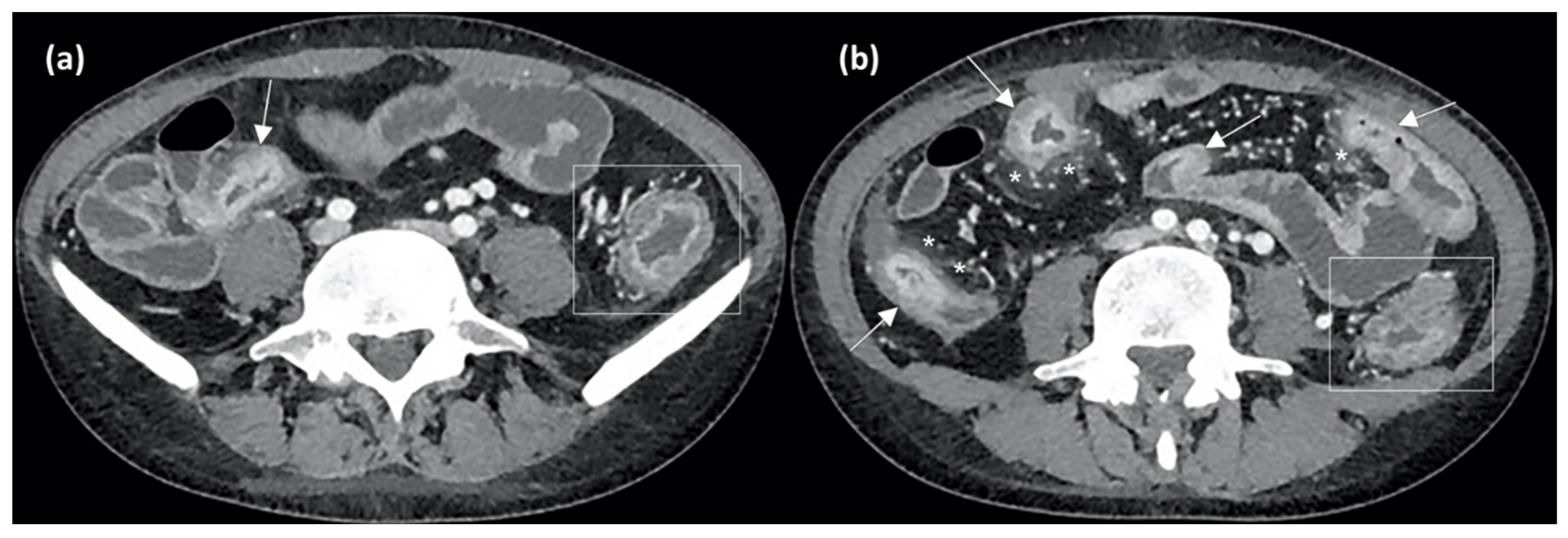 Jcm 12 05933 g005 Jcm 12 05933 g005
