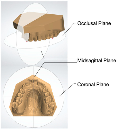 Essential requirements of a non-occlusal mandibu- lar reference