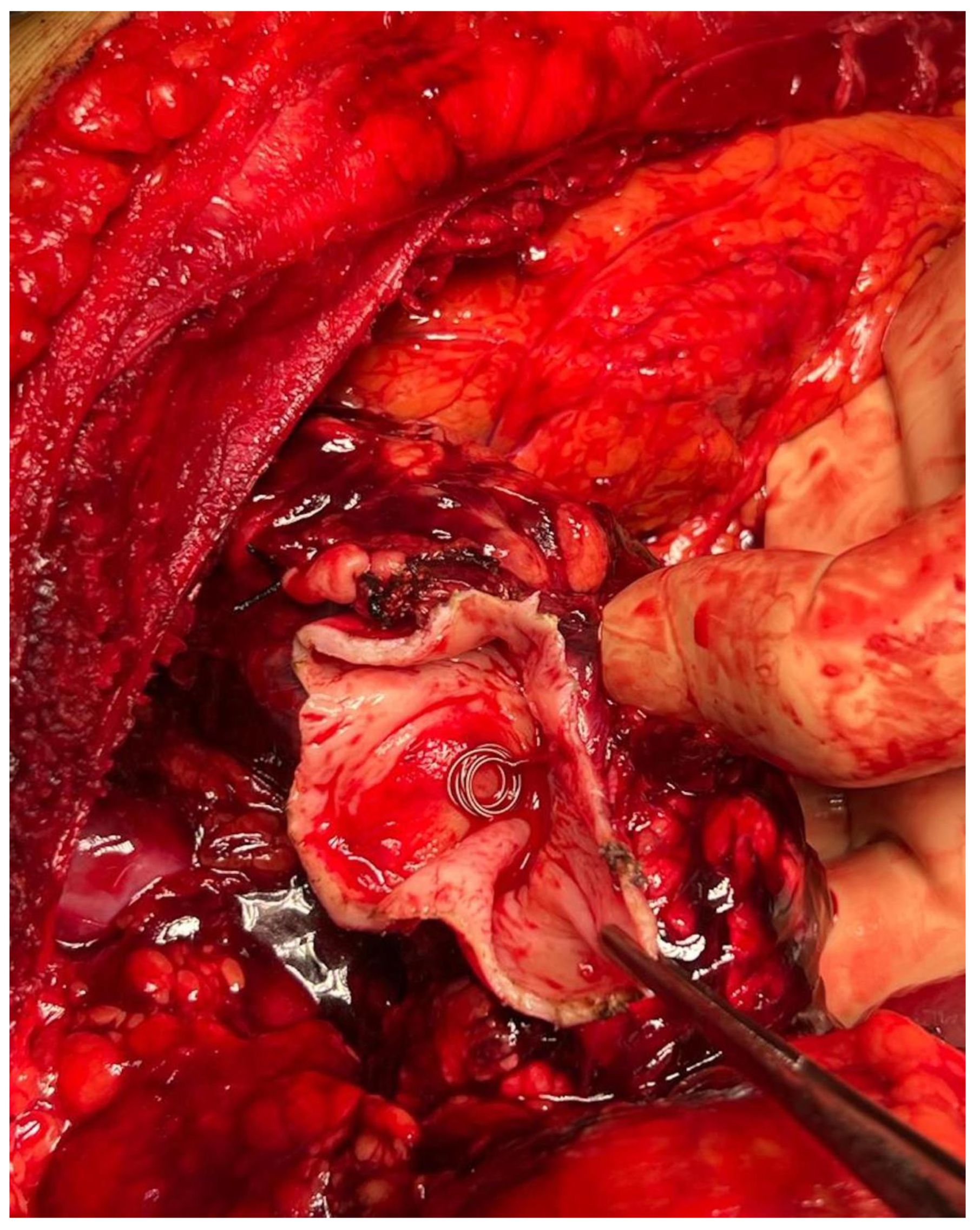 Jcm 12 06085 g007 Jcm 12 06085 g007