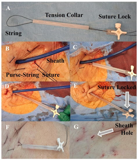 Surgical Sutures | Stitches medical, Surgical suture, Medical knowledge