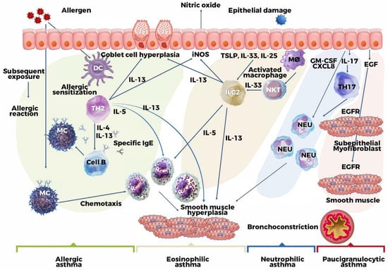 JCM | Free Full-Text | Asthma Phenotypes in the Era of Personalized ...