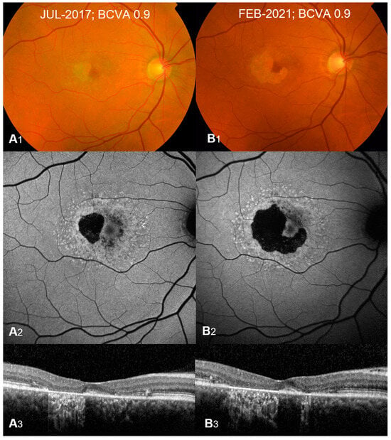 JCM  October-2 2021 - Browse Articles