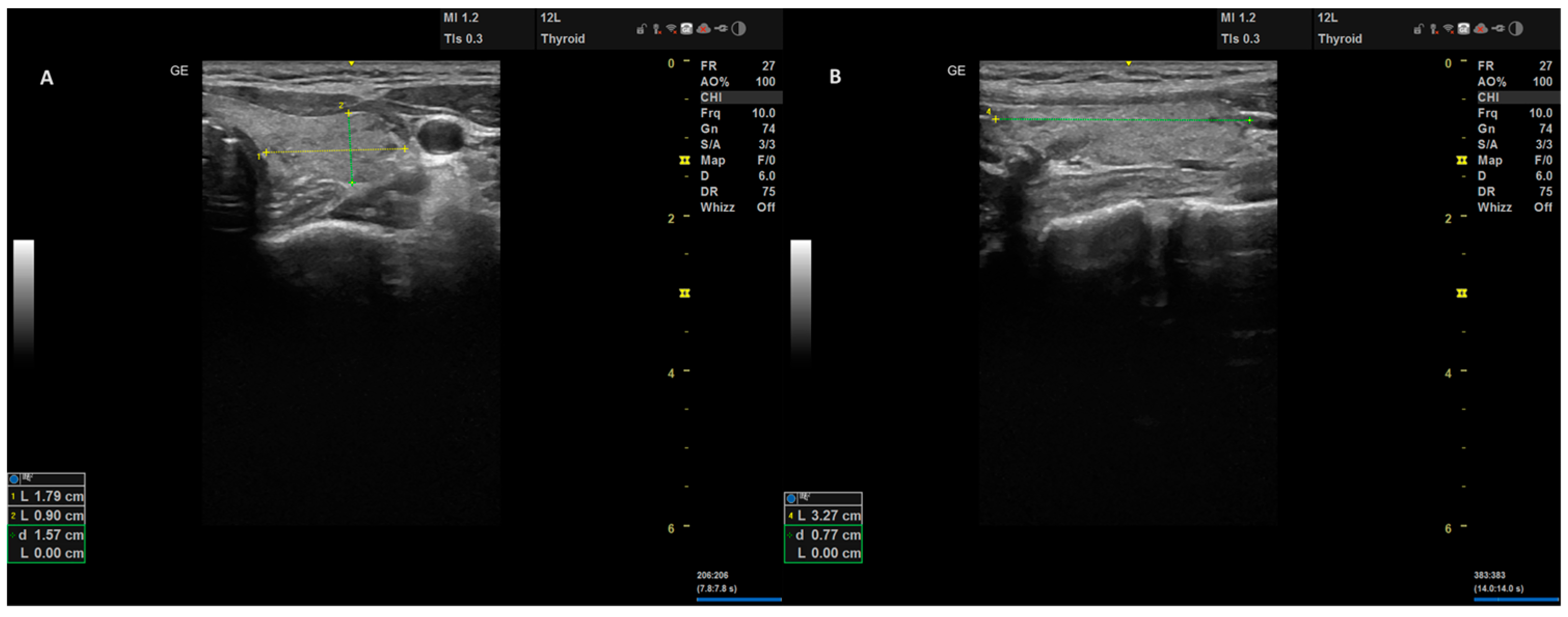 JCM Free Full Text Unveiling The Accuracy Of Ultrasonographic   Jcm 12 06619 G002 