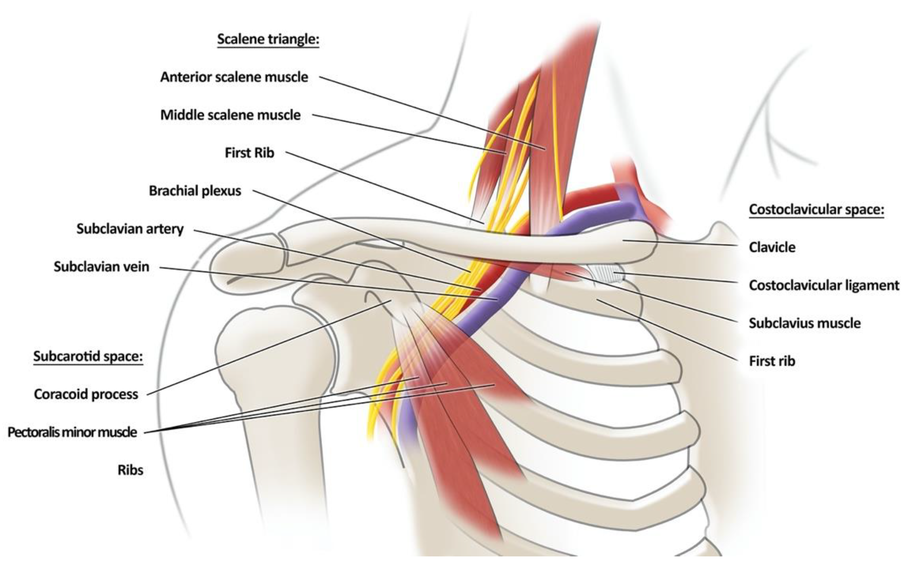 Thoracic Outlet Syndrome: Review of Surgical Approaches and