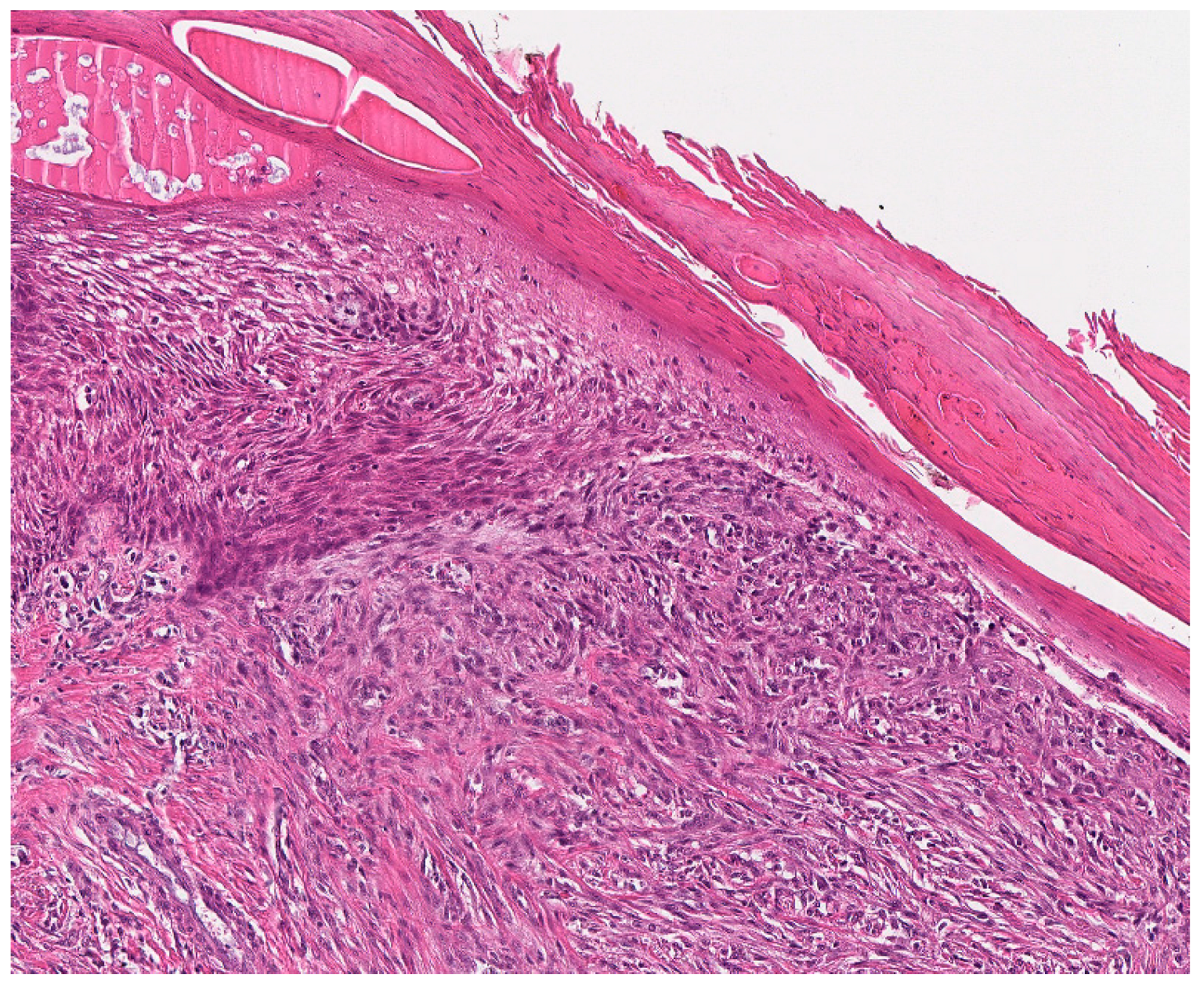 4: Anatomical illustrations: fascia enclosures, e.g., fascia lata