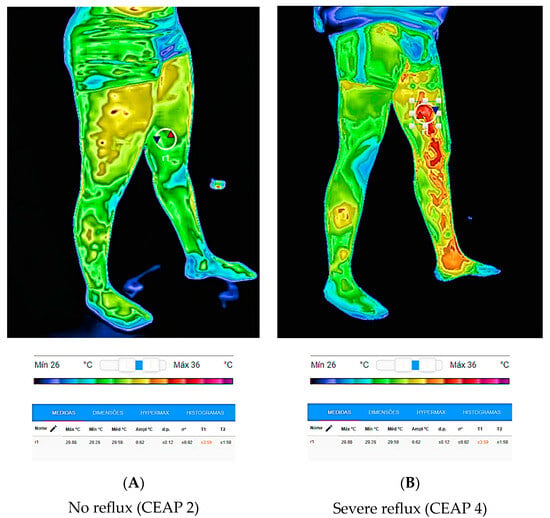 https://www.mdpi.com/jcm/jcm-12-07085/article_deploy/html/images/jcm-12-07085-g003-550.jpg