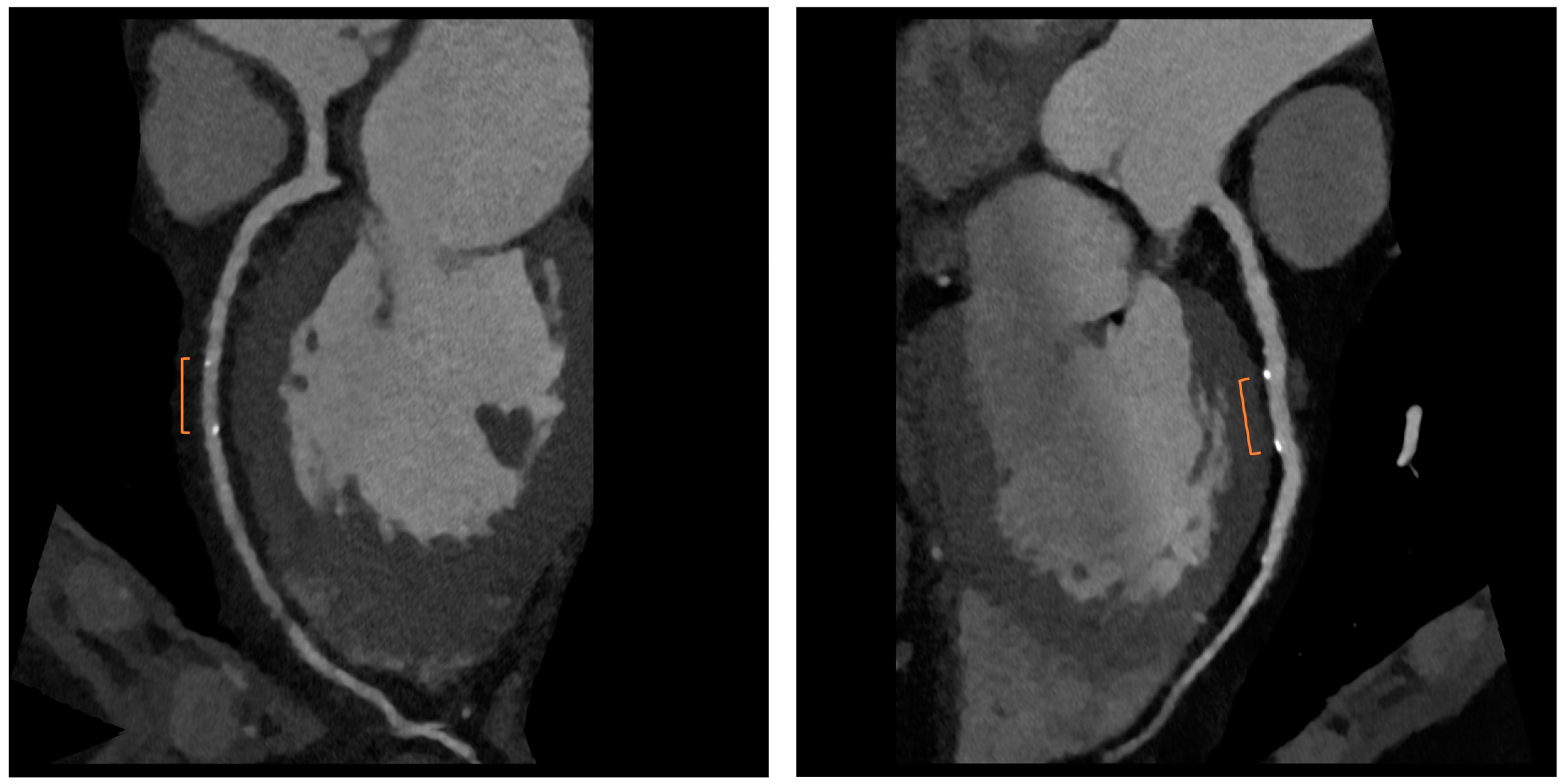 Jcm 12 07104 g003 Jcm 12 07104 g003