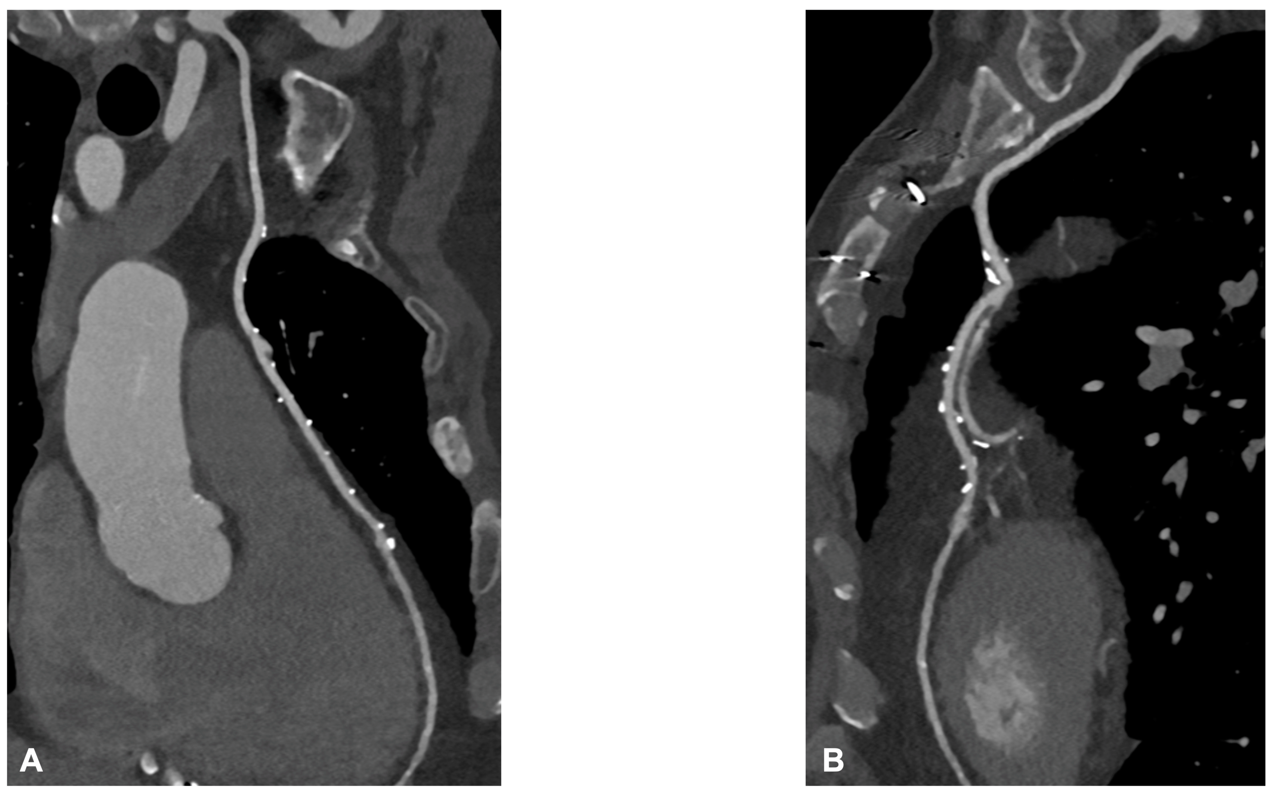 Jcm 12 07104 g005 Jcm 12 07104 g005