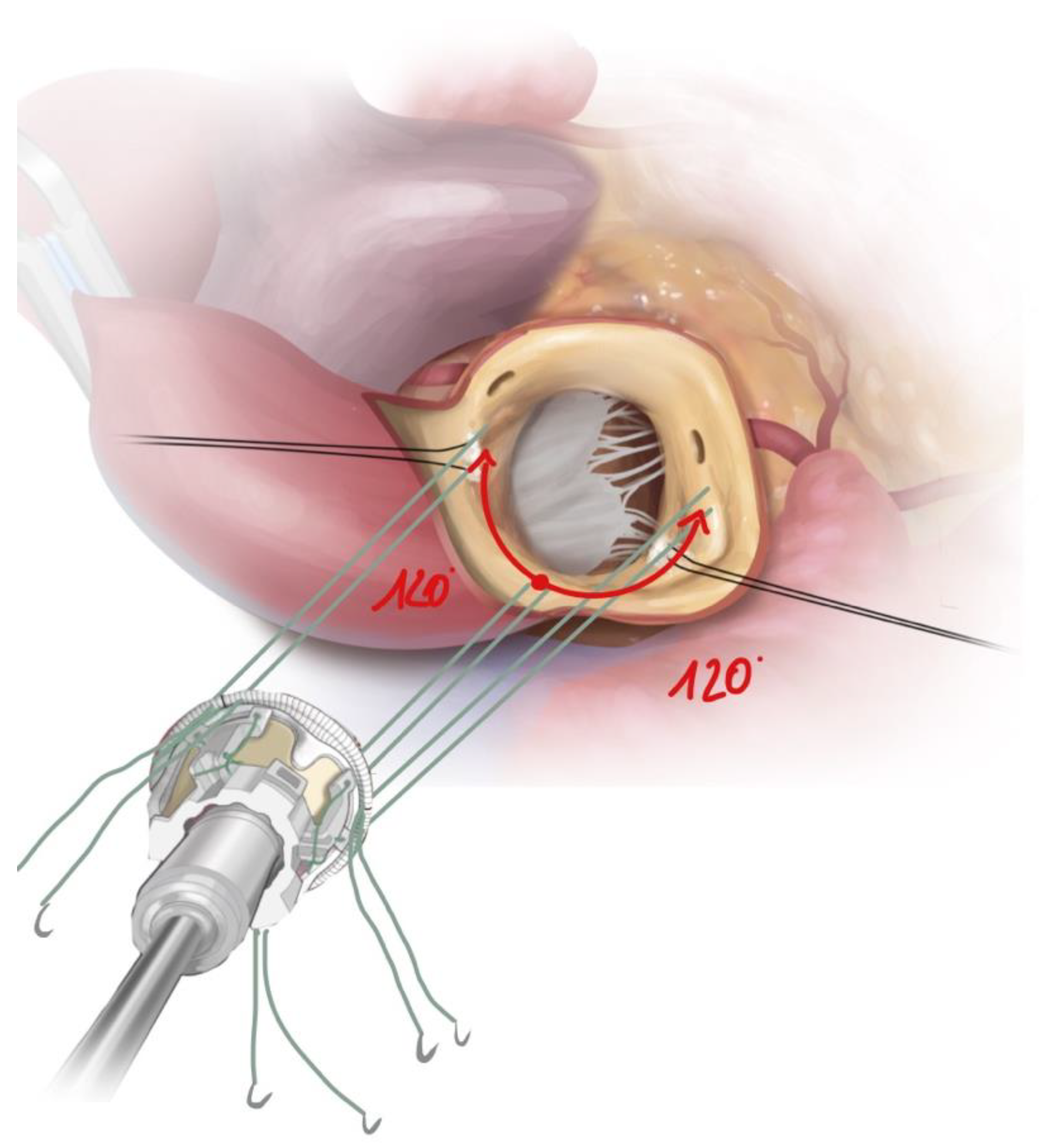 Jcm 12 07390 g003 Jcm 12 07390 g003