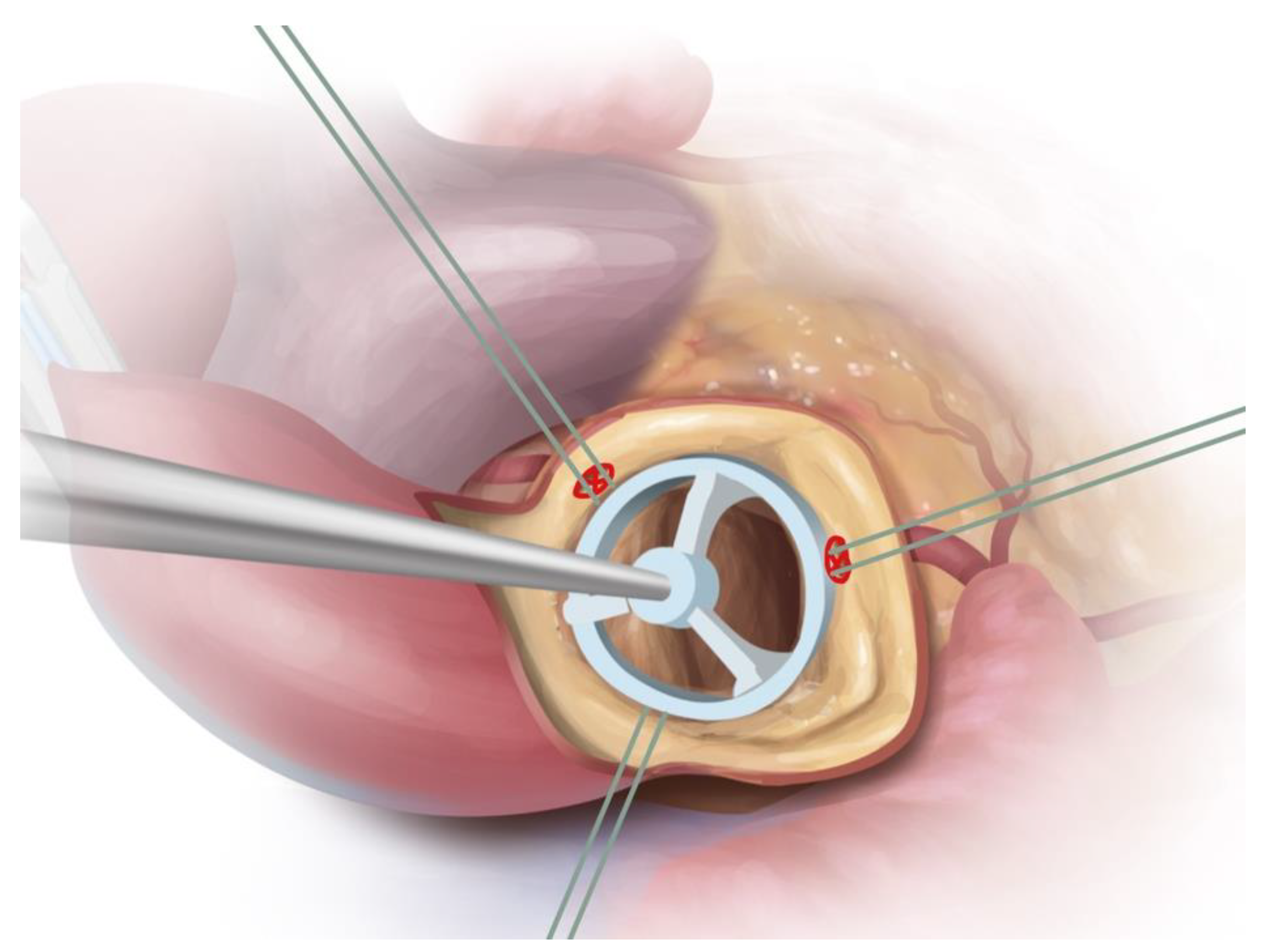 Jcm 12 07390 g004 Jcm 12 07390 g004