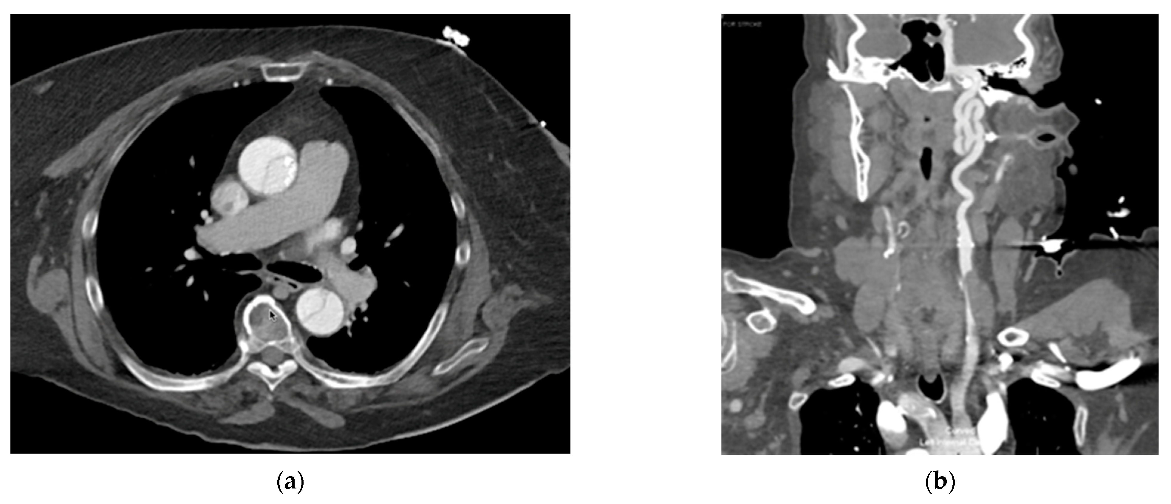 Jcm 12 07630 g002 Jcm 12 07630 g002
