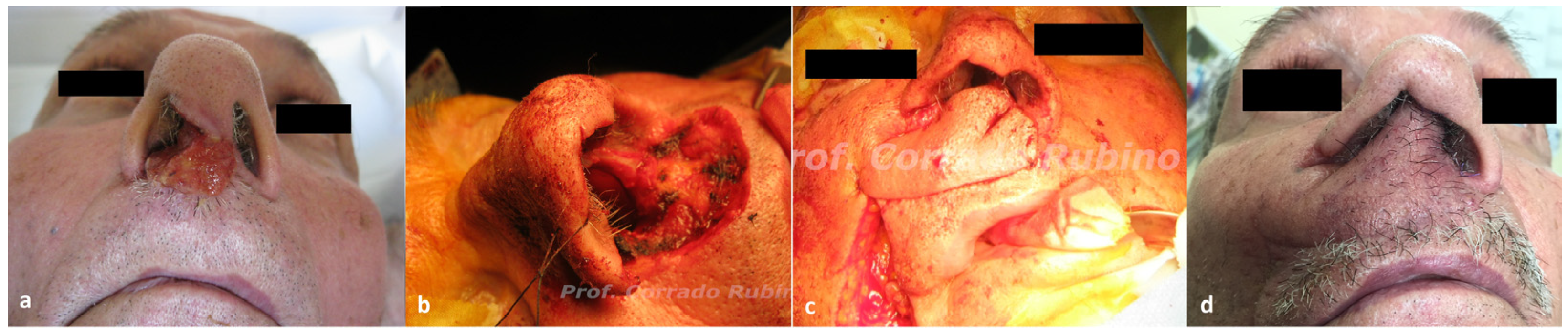 Jcm 13 00541 g002 Jcm 13 00541 g002