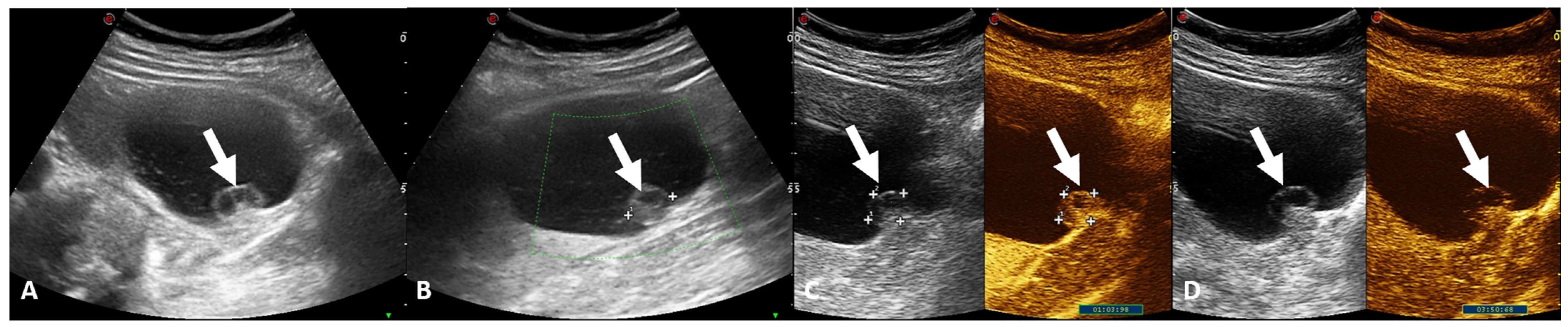 Jcm 13 00547 g002 Jcm 13 00547 g002