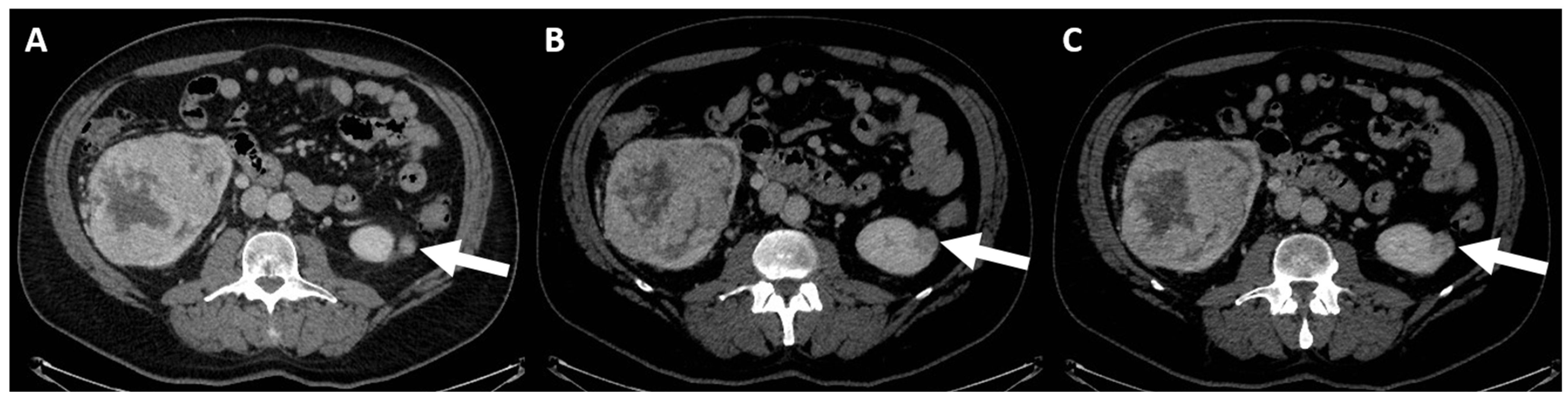 Jcm 13 00547 g004 Jcm 13 00547 g004