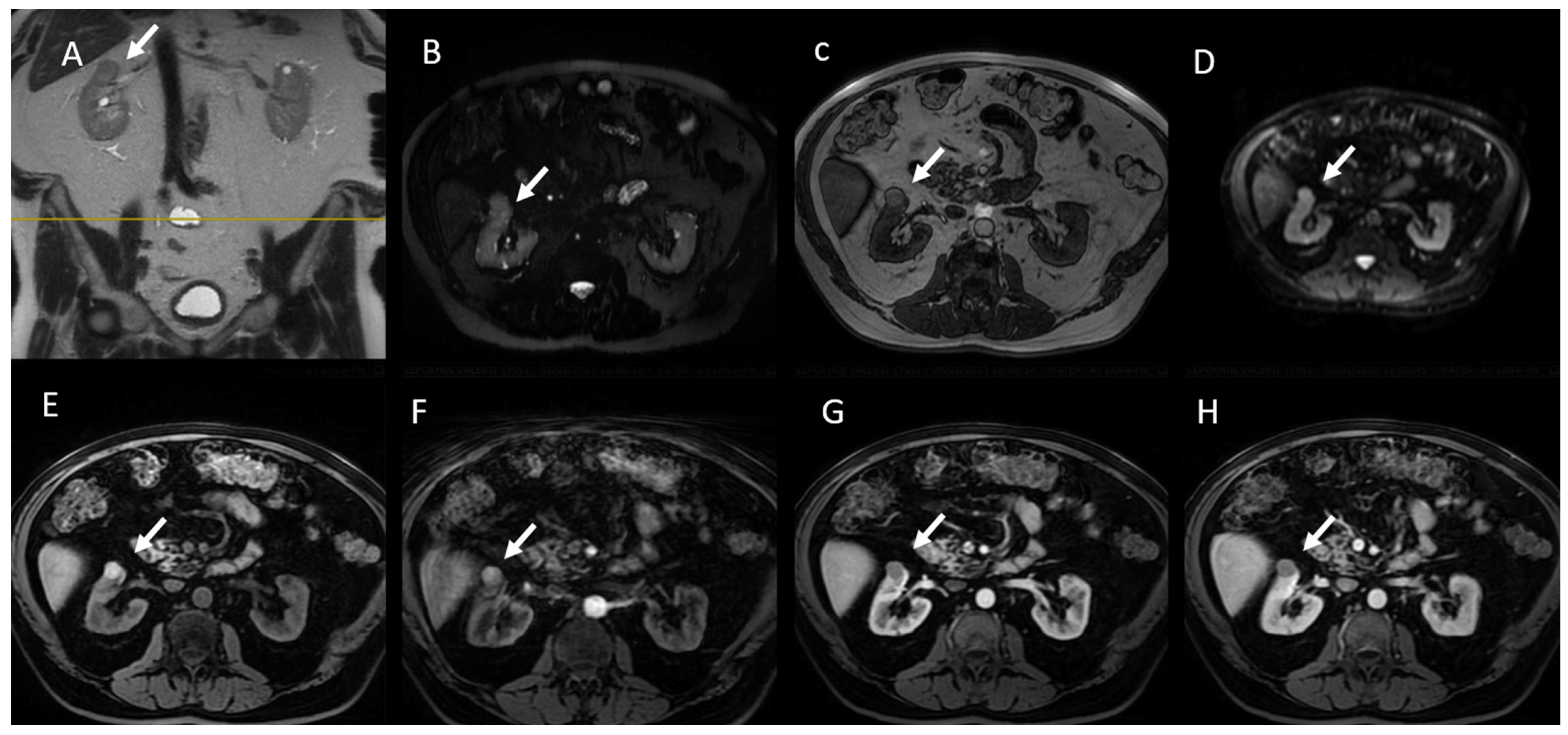 Jcm 13 00547 g006 Jcm 13 00547 g006