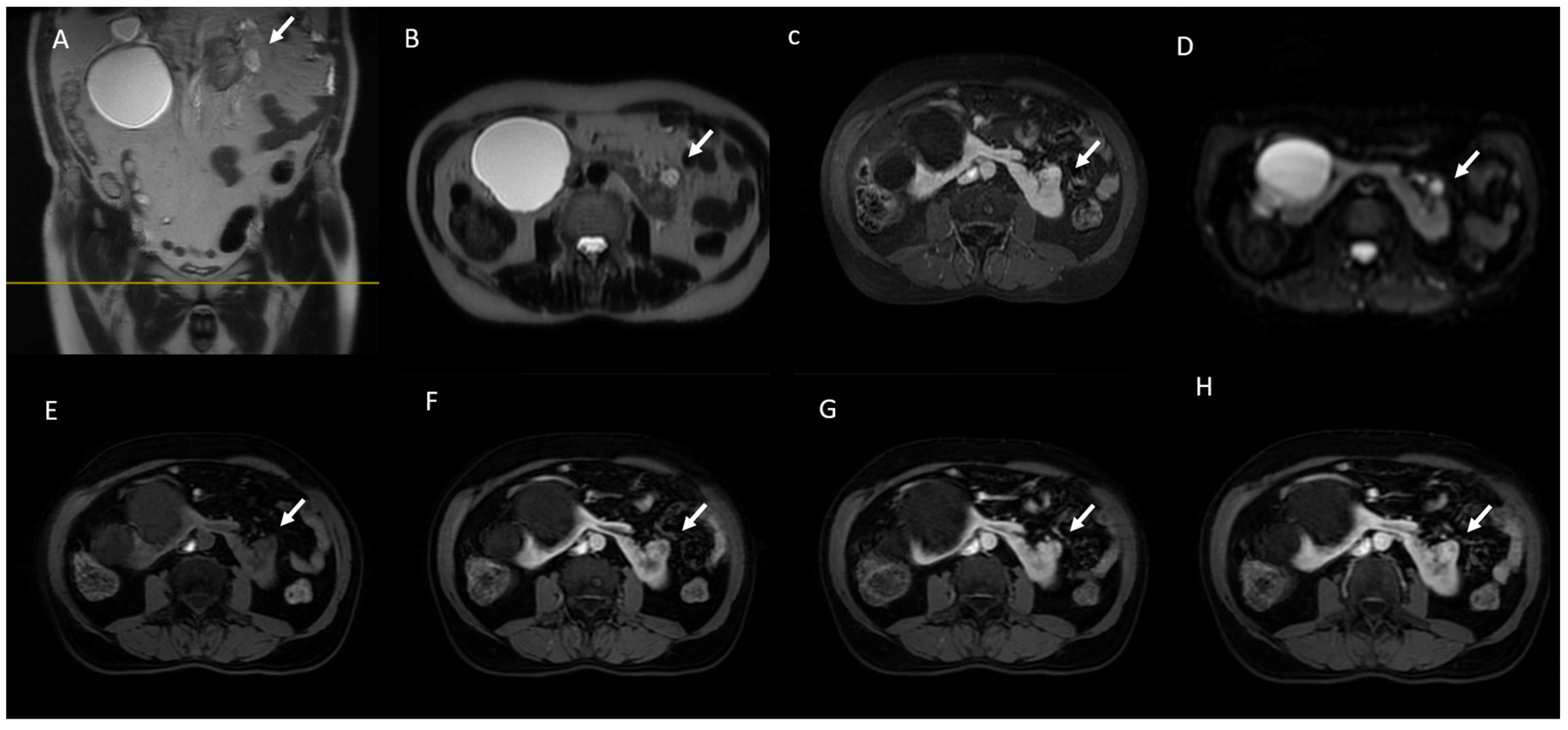 Jcm 13 00547 g007 Jcm 13 00547 g007