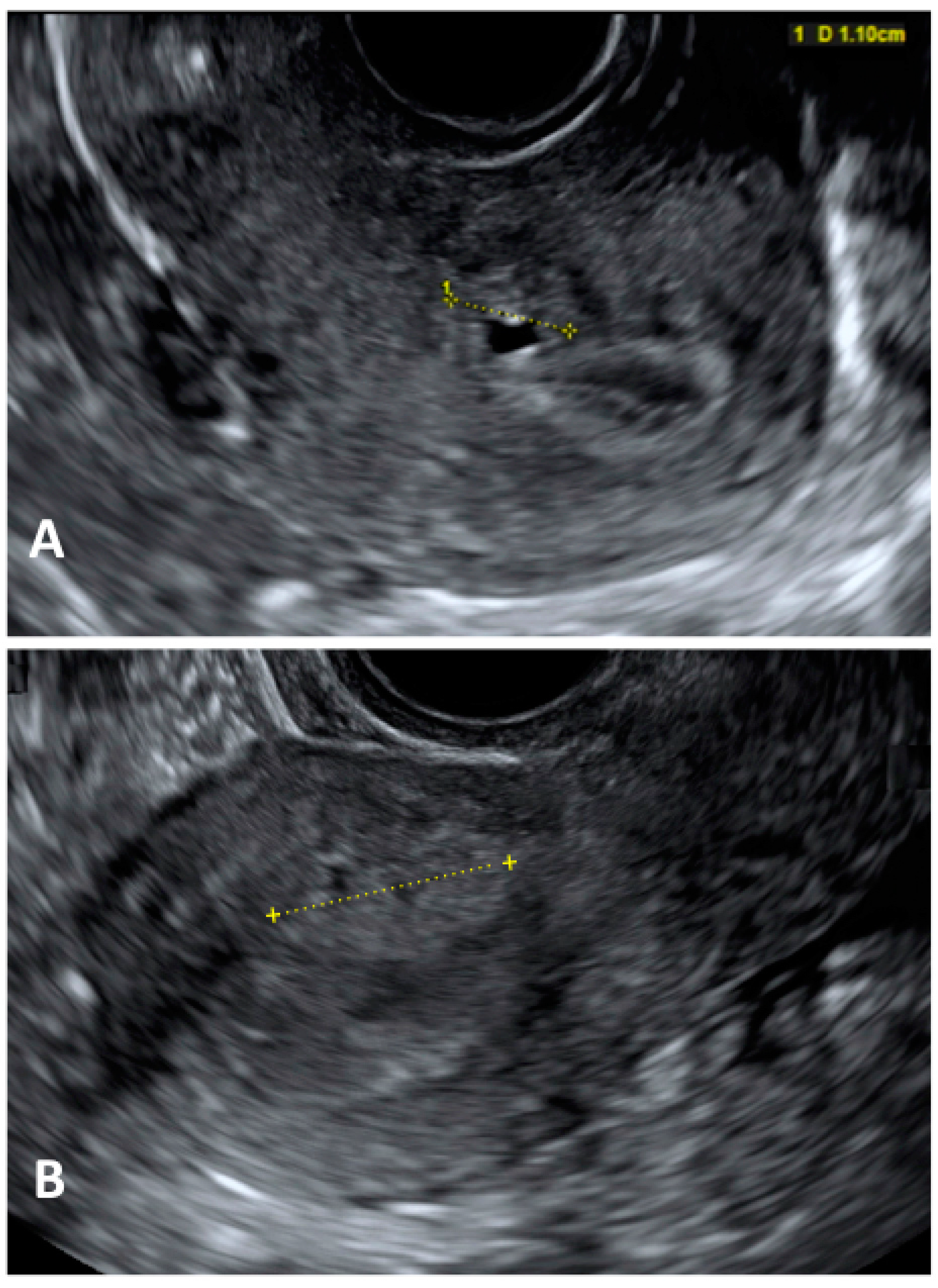 Jcm 13 00550 g002 Jcm 13 00550 g002