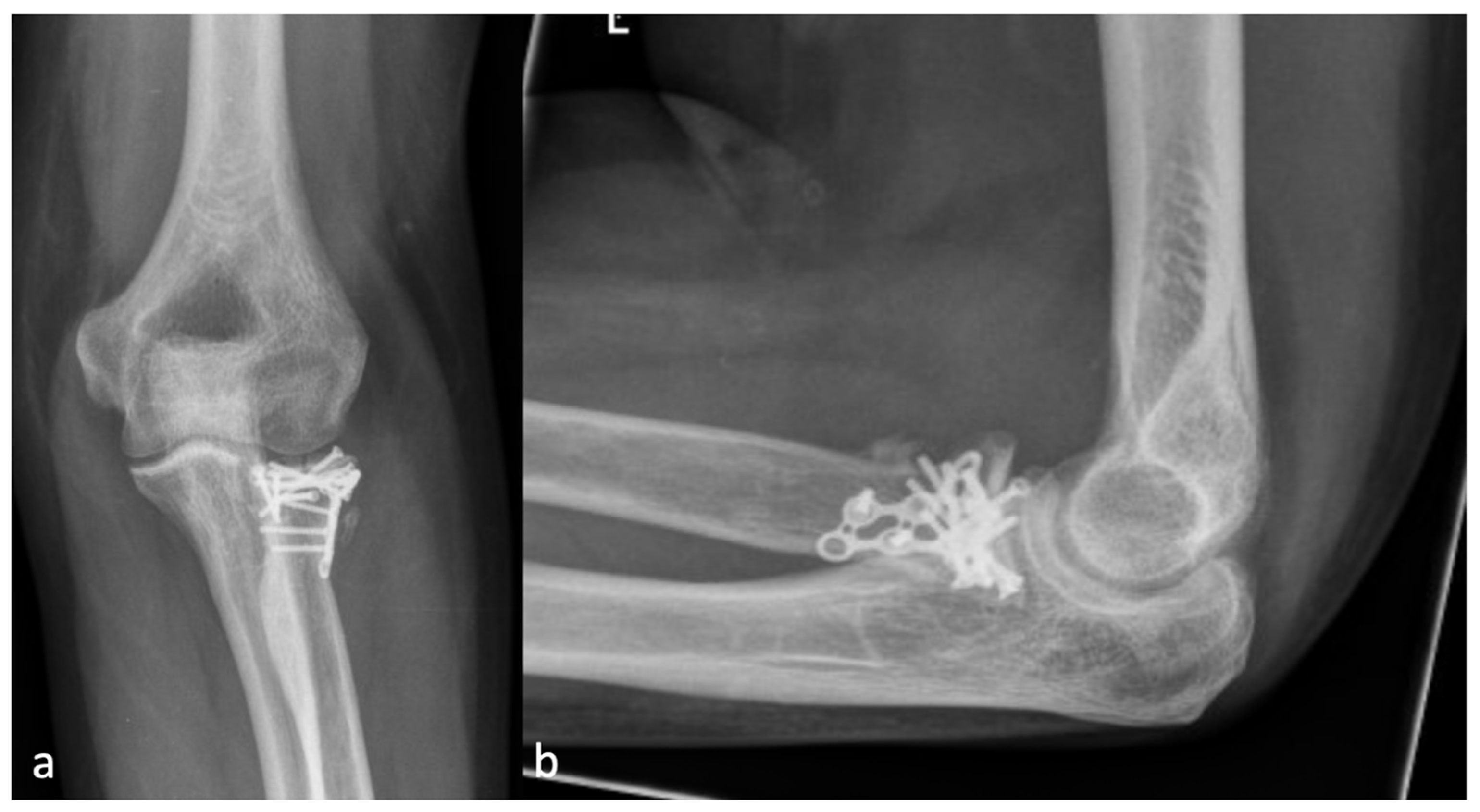 Jcm 13 00667 g002 Jcm 13 00667 g002