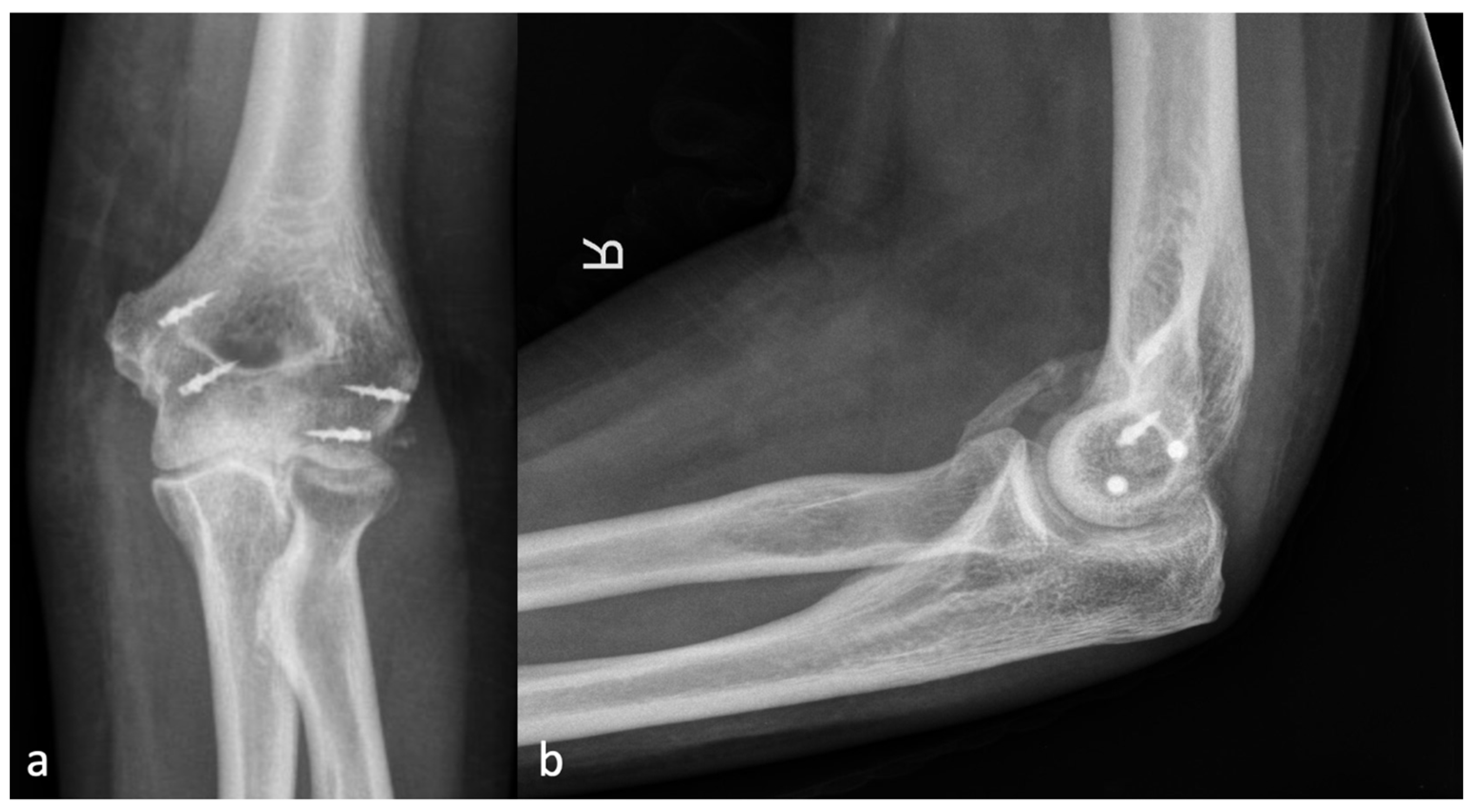 Jcm 13 00667 g004 Jcm 13 00667 g004