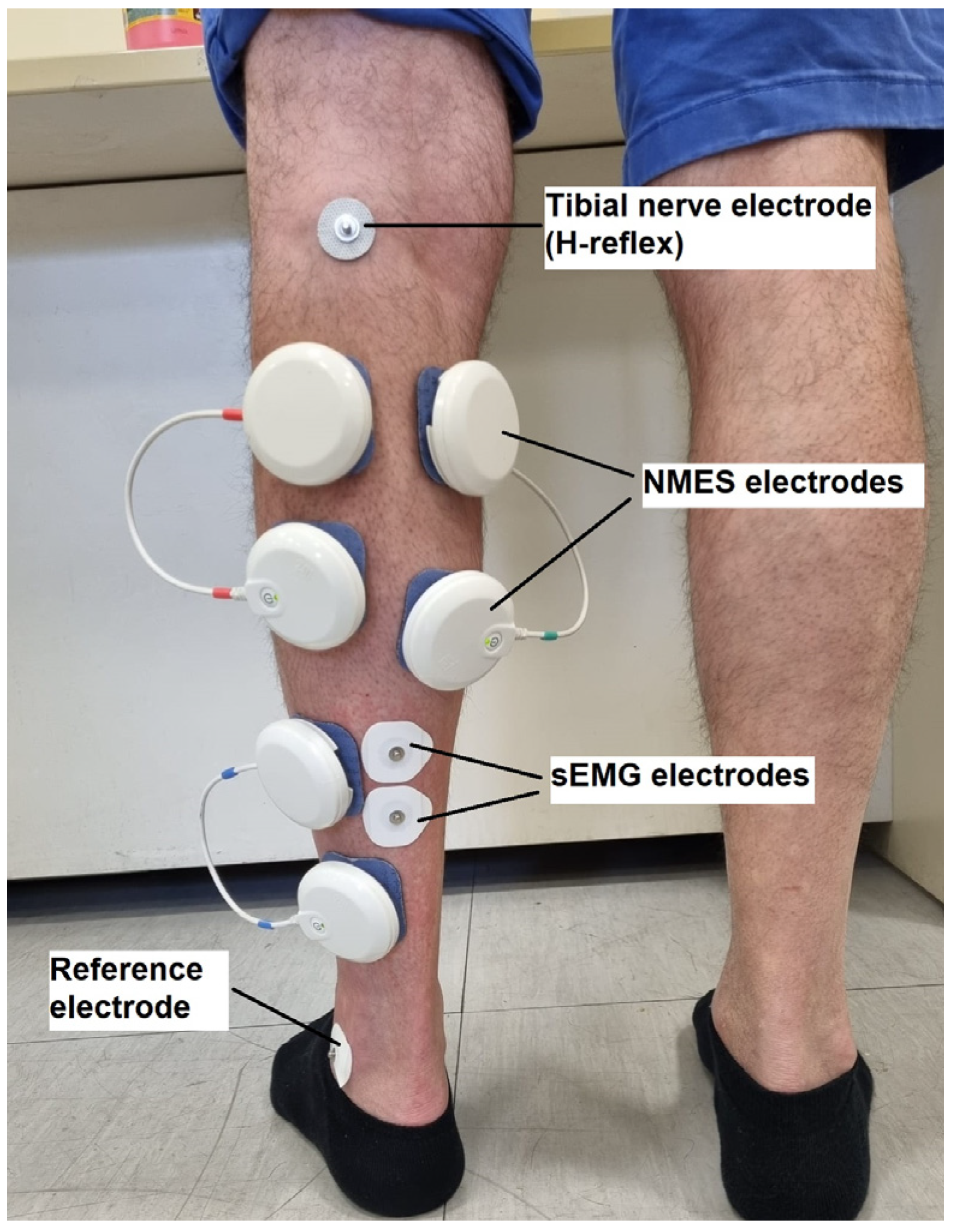 Jcm 13 00704 g002 Jcm 13 00704 g002