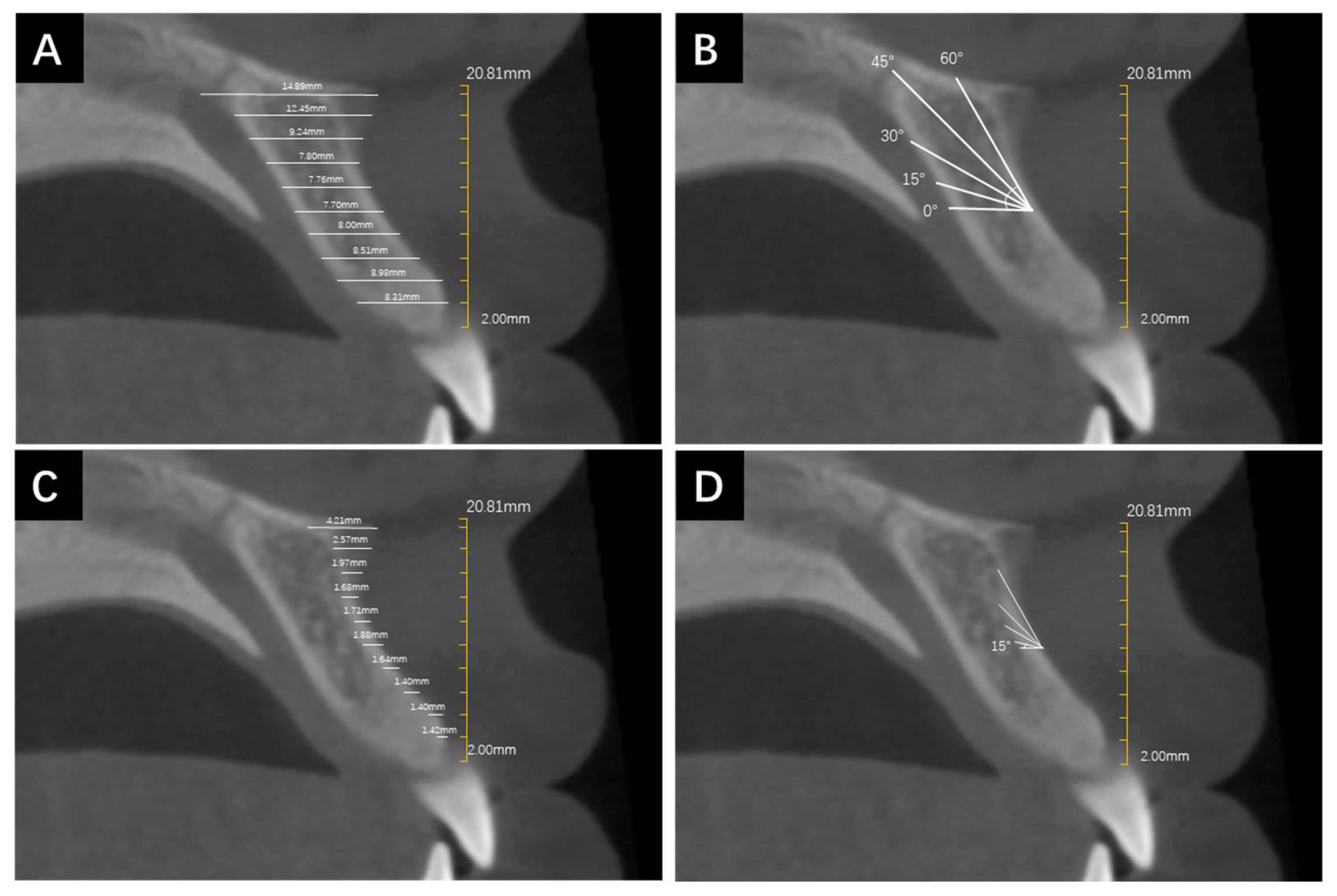 Jcm 13 00837 g002 Jcm 13 00837 g002