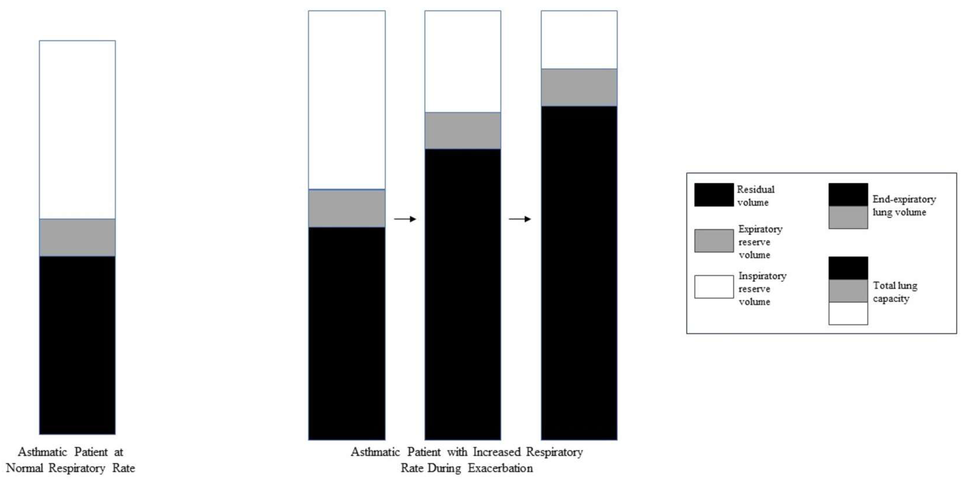 JCM Free Full Text Critical Care Management of Severe Asthma