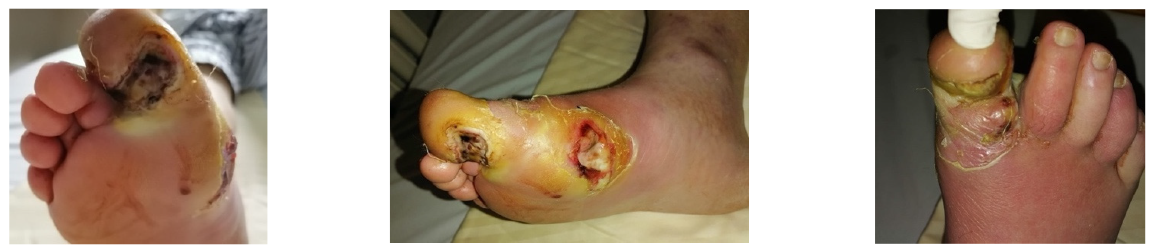 Jcm 13 00883 g008 Jcm 13 00883 g008