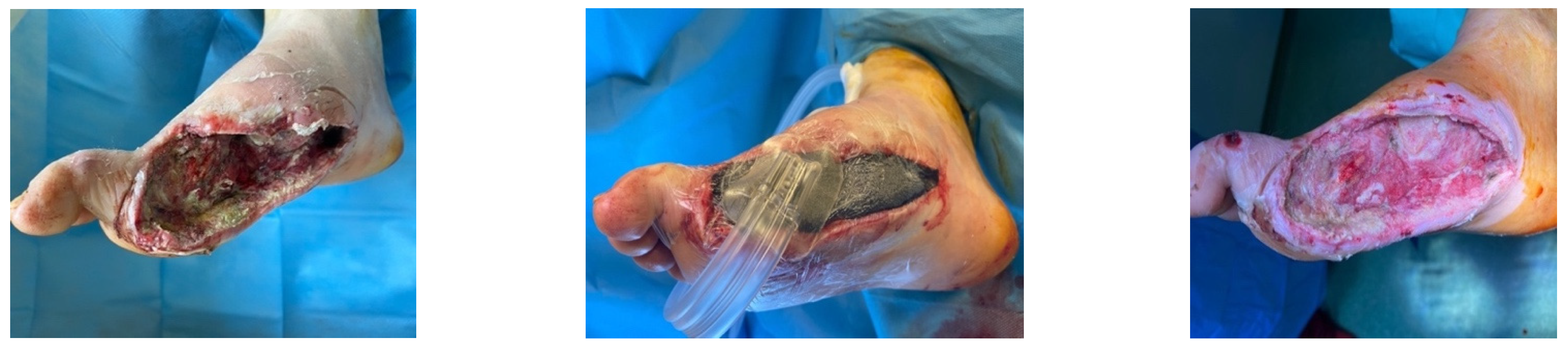 Jcm 13 00883 g009 Jcm 13 00883 g009