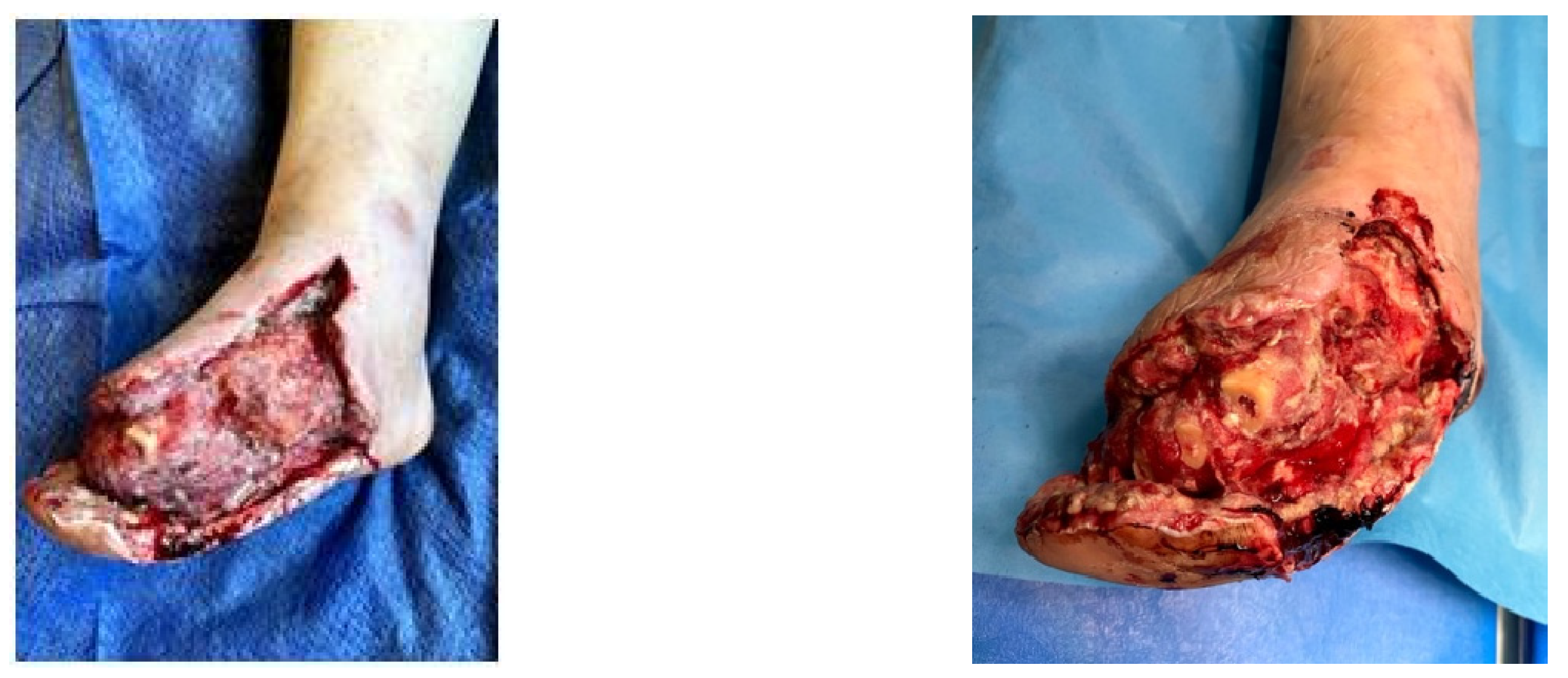 Jcm 13 00883 g011 Jcm 13 00883 g011