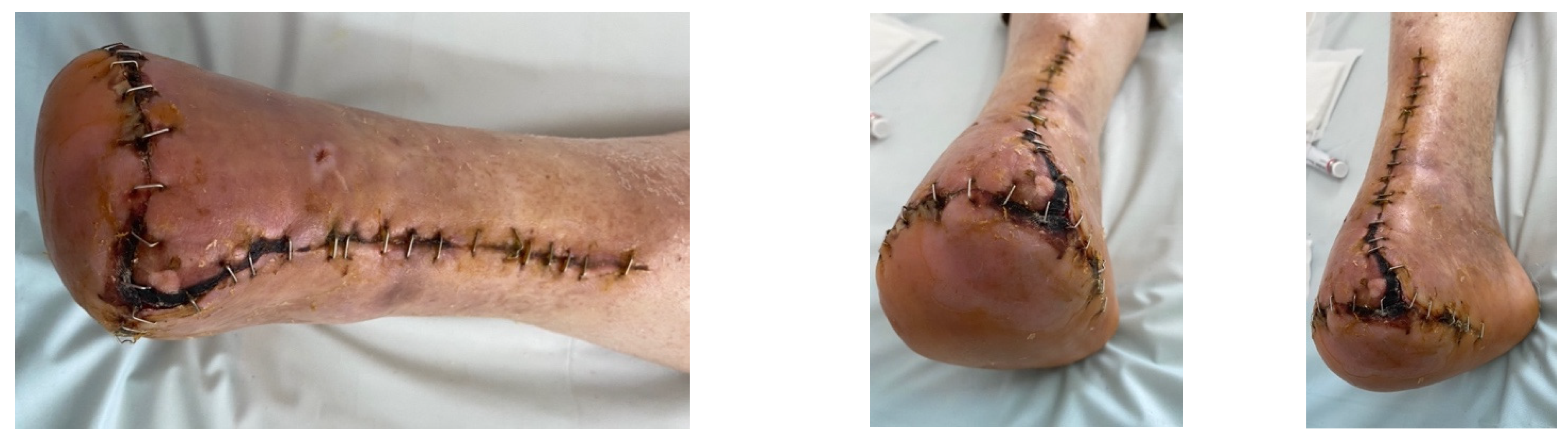 Jcm 13 00883 g016 Jcm 13 00883 g016