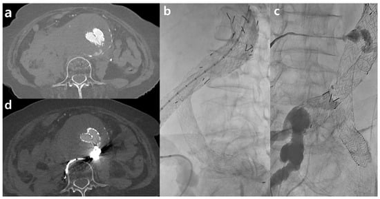 JCM Free Full Text Evaluating Image Quality and Radiation Dose