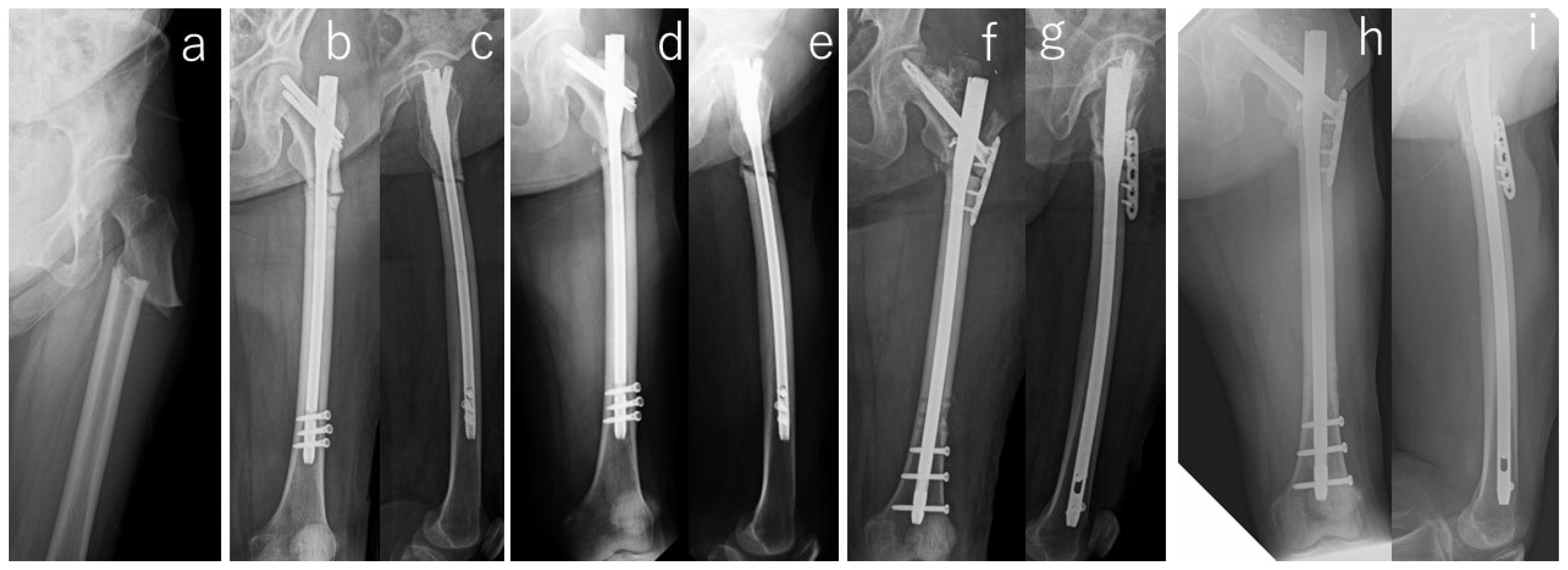 Jcm 13 01027 g001 Jcm 13 01027 g001