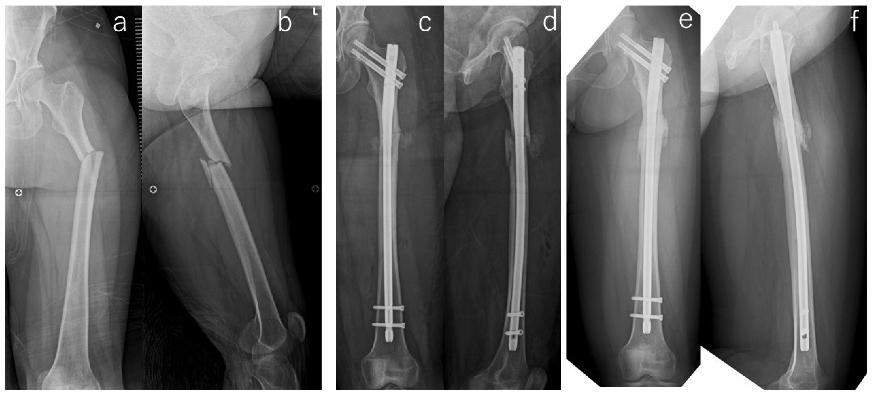 Jcm 13 01027 g002 Jcm 13 01027 g002