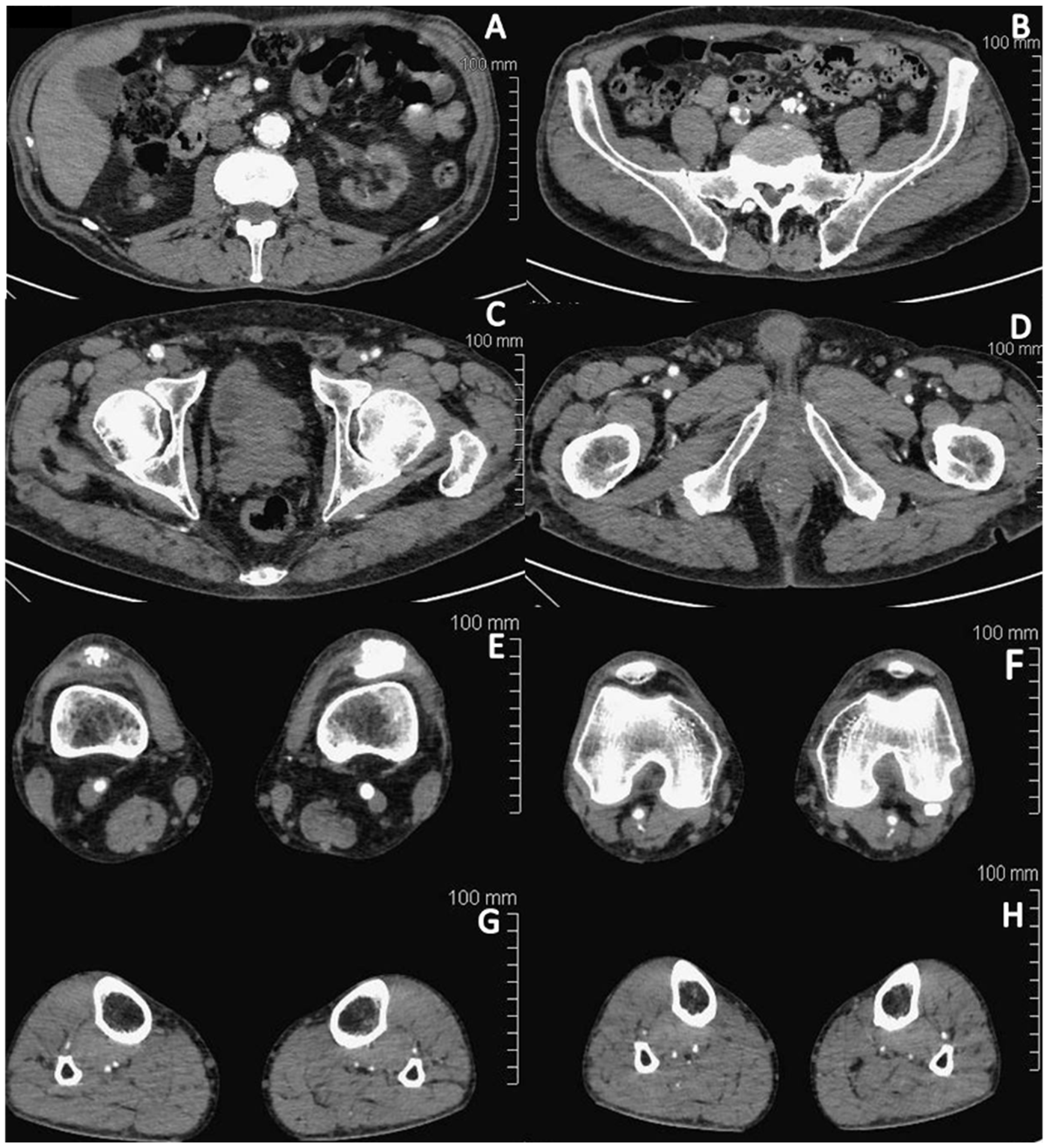 Jcm 13 01121 g001 Jcm 13 01121 g001