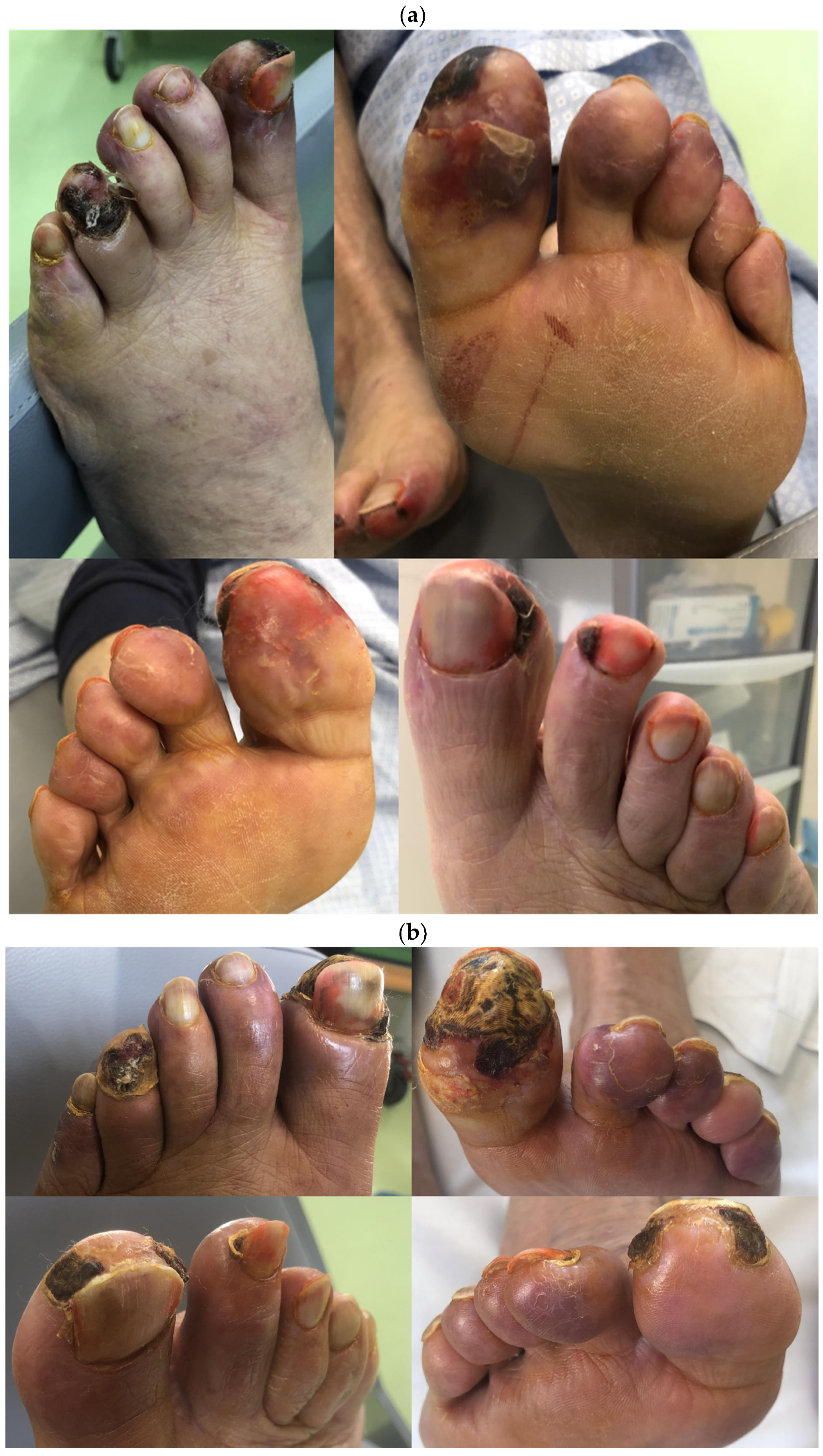 Jcm 13 01121 g003a Jcm 13 01121 g003a