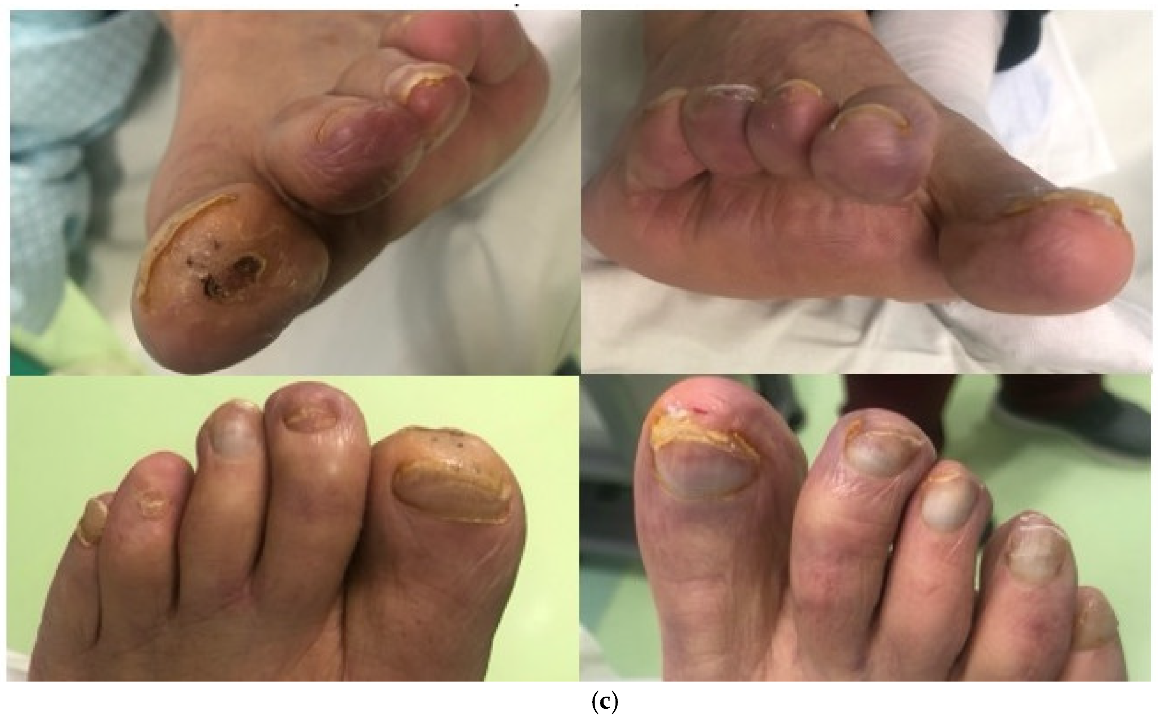 Jcm 13 01121 g003b Jcm 13 01121 g003b