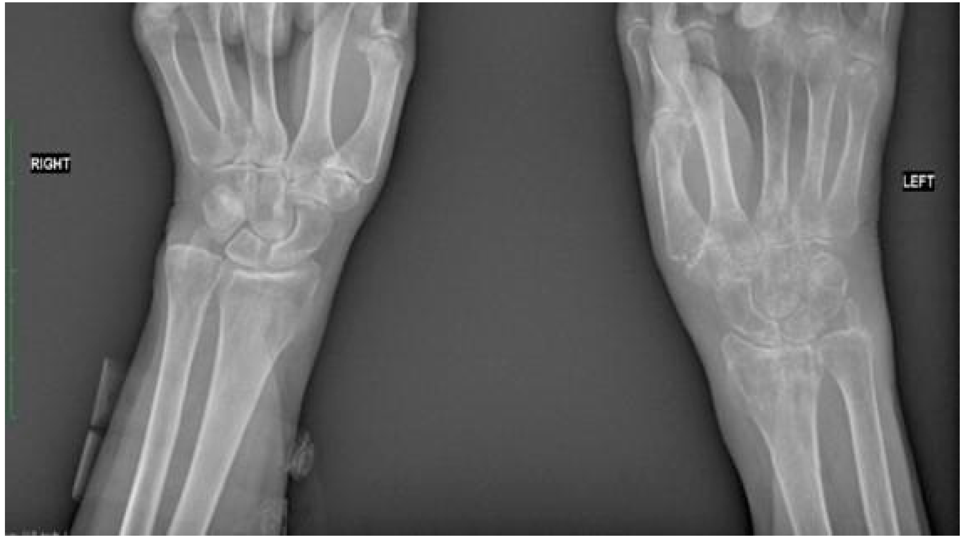 Jcm 13 01122 g002 Jcm 13 01122 g002