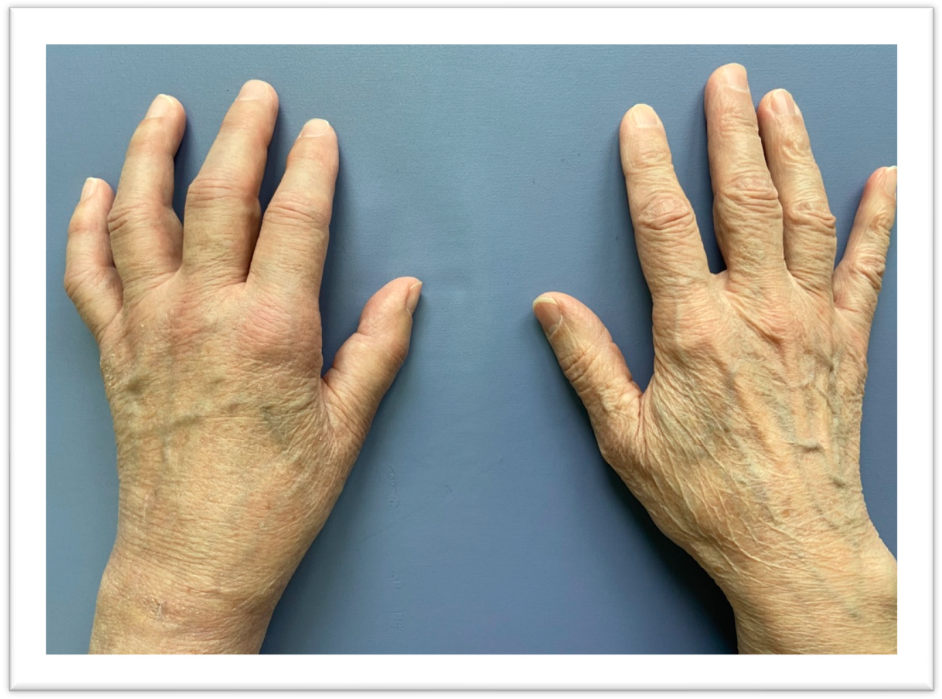 Jcm 13 01122 g005 Jcm 13 01122 g005