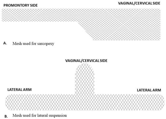 A Case of Laparoscopic Sacrohysteropexy: A Uterus Preserving