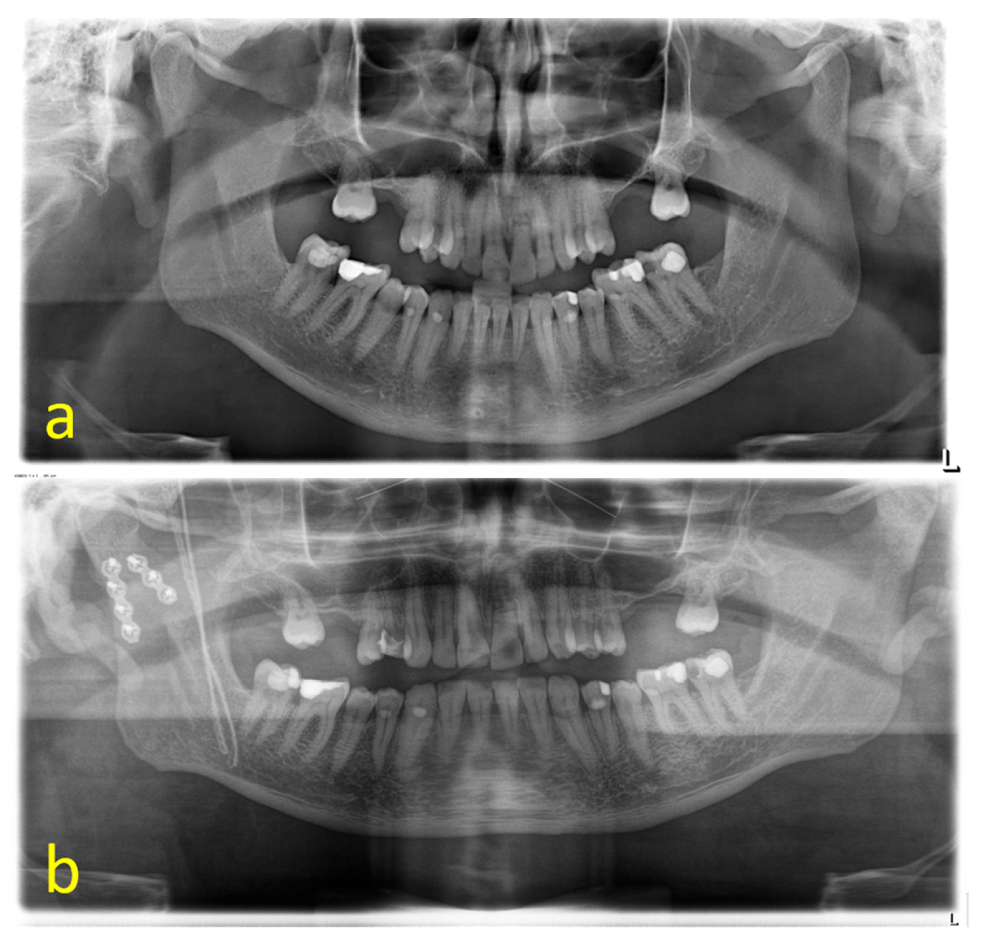 JCM | Free Full-Text | Patient’s Perception of Outcome after ...