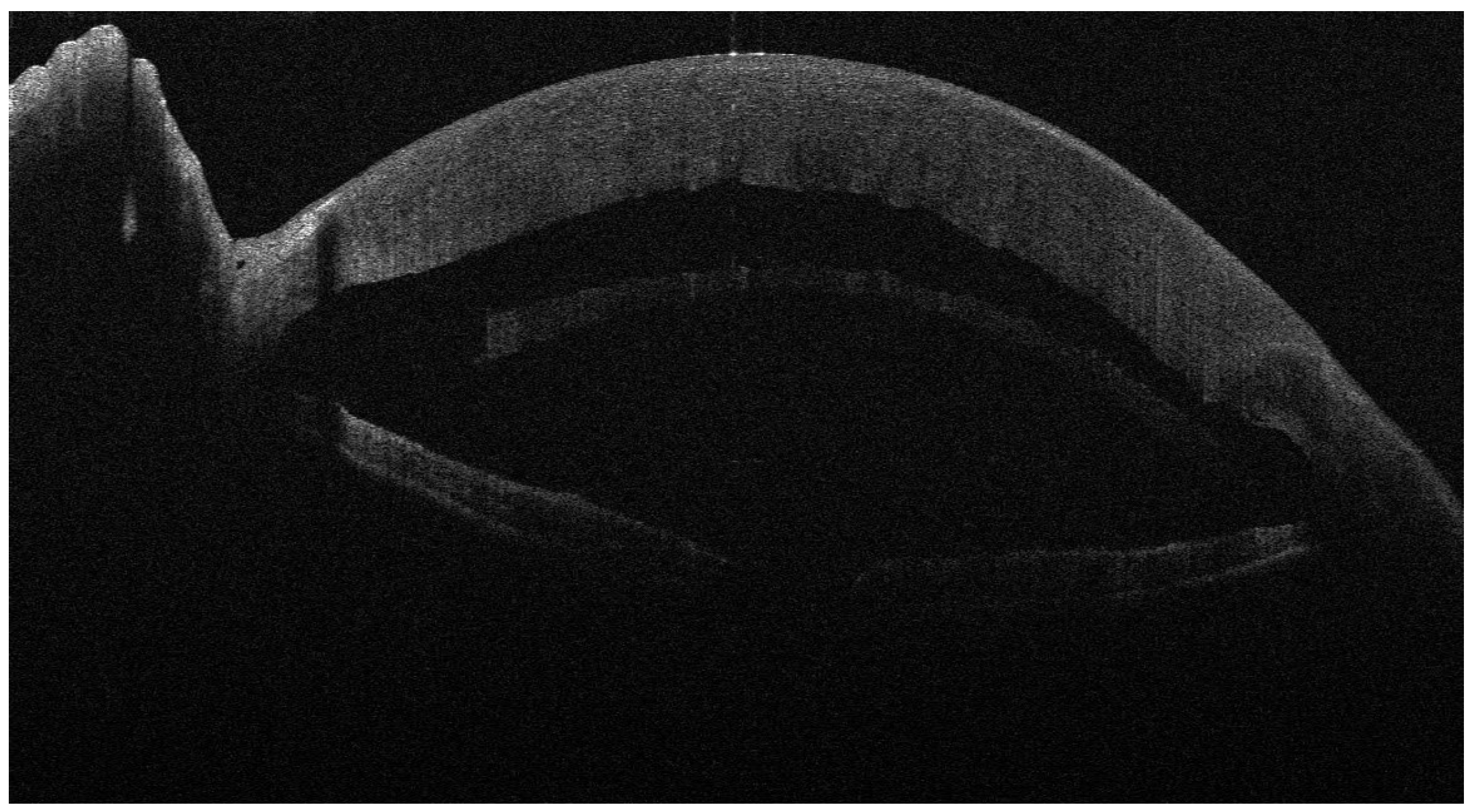 Jcm 13 01593 g003 Jcm 13 01593 g003