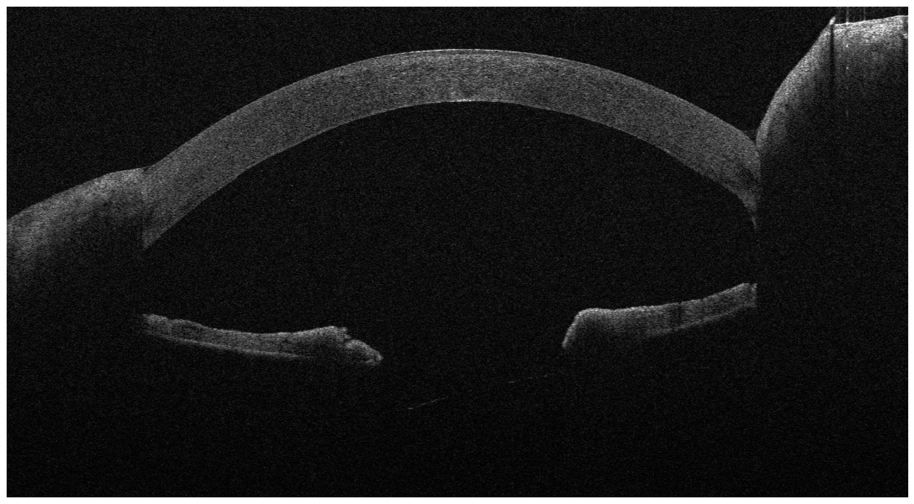 Jcm 13 01593 g006 Jcm 13 01593 g006