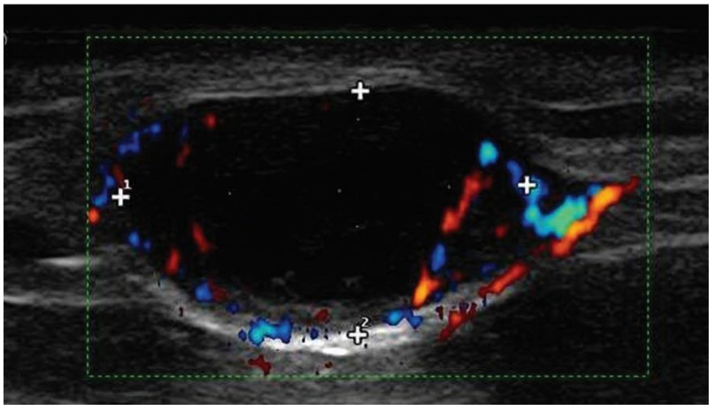 Jcm 13 01607 g002 Jcm 13 01607 g002